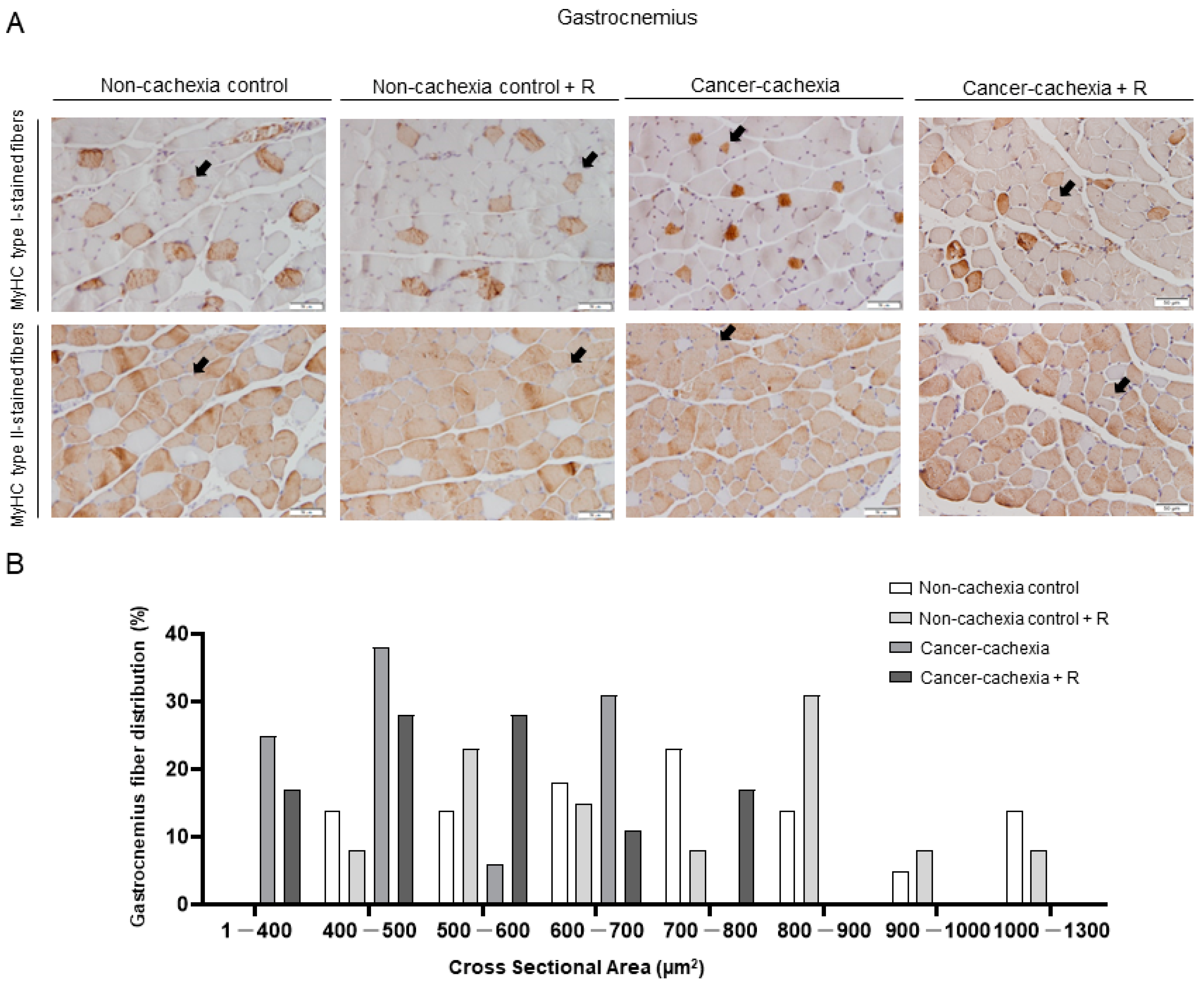 Cancers 14 02894 g004