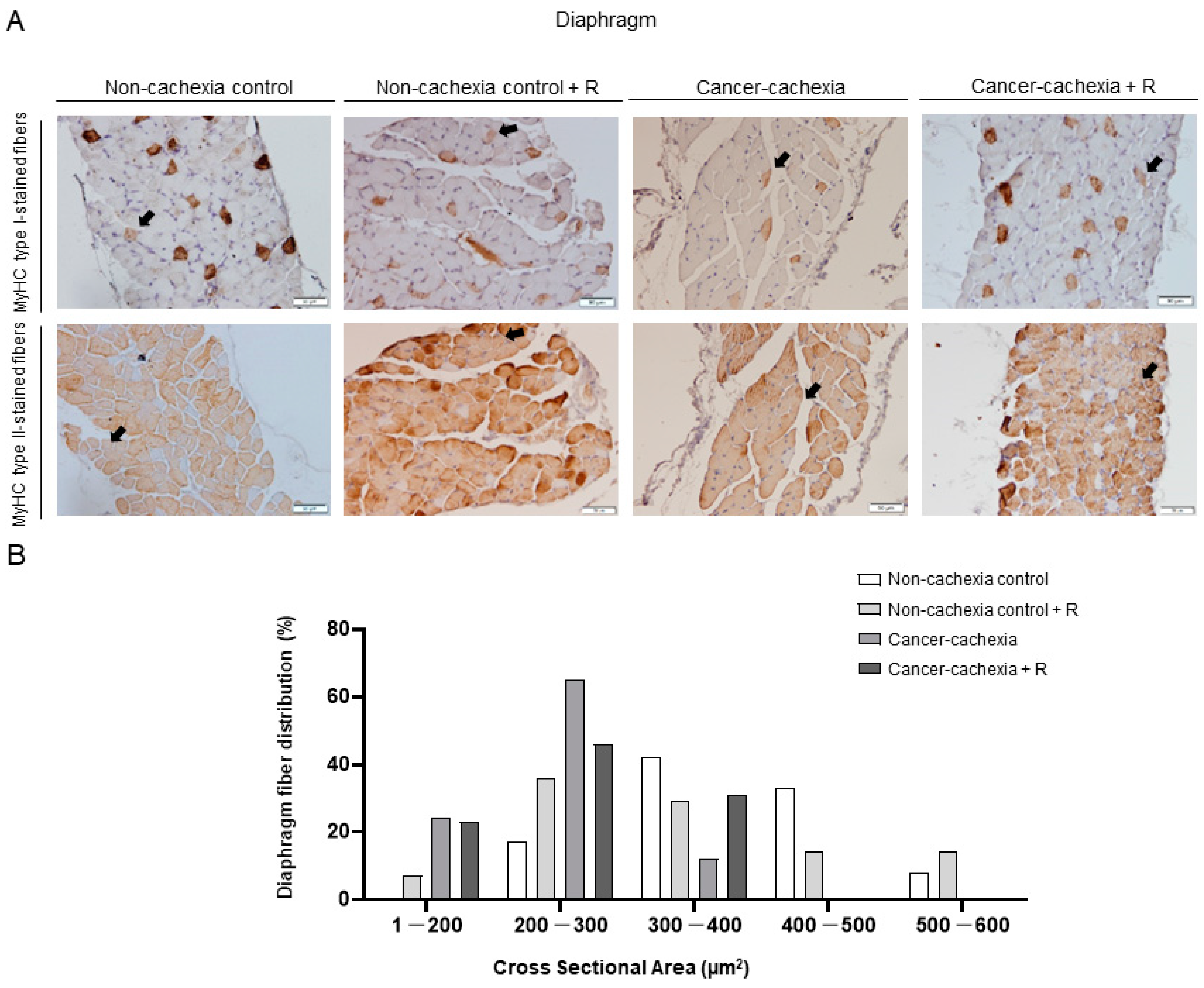 Cancers 14 02894 g005