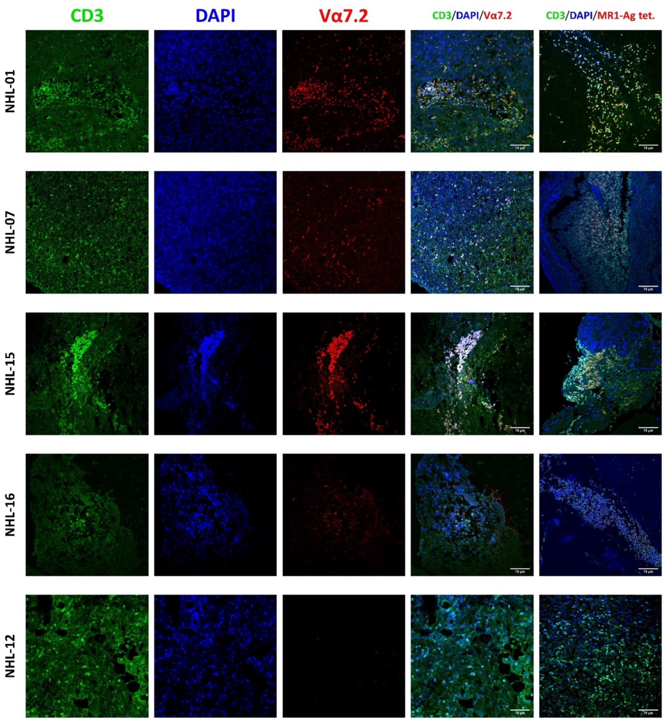 Cancers 14 02921 g002