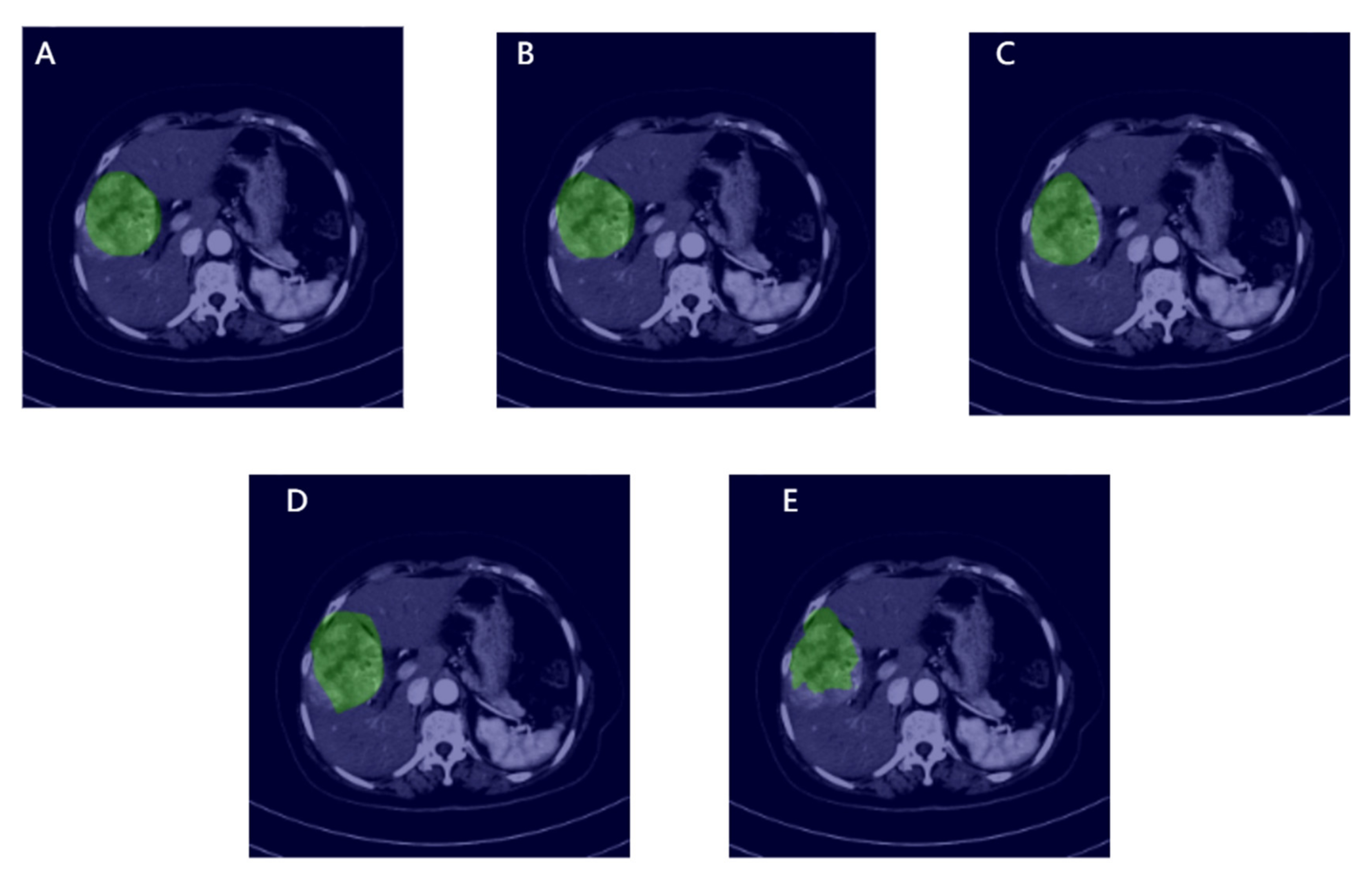 Cancers 14 02956 g005