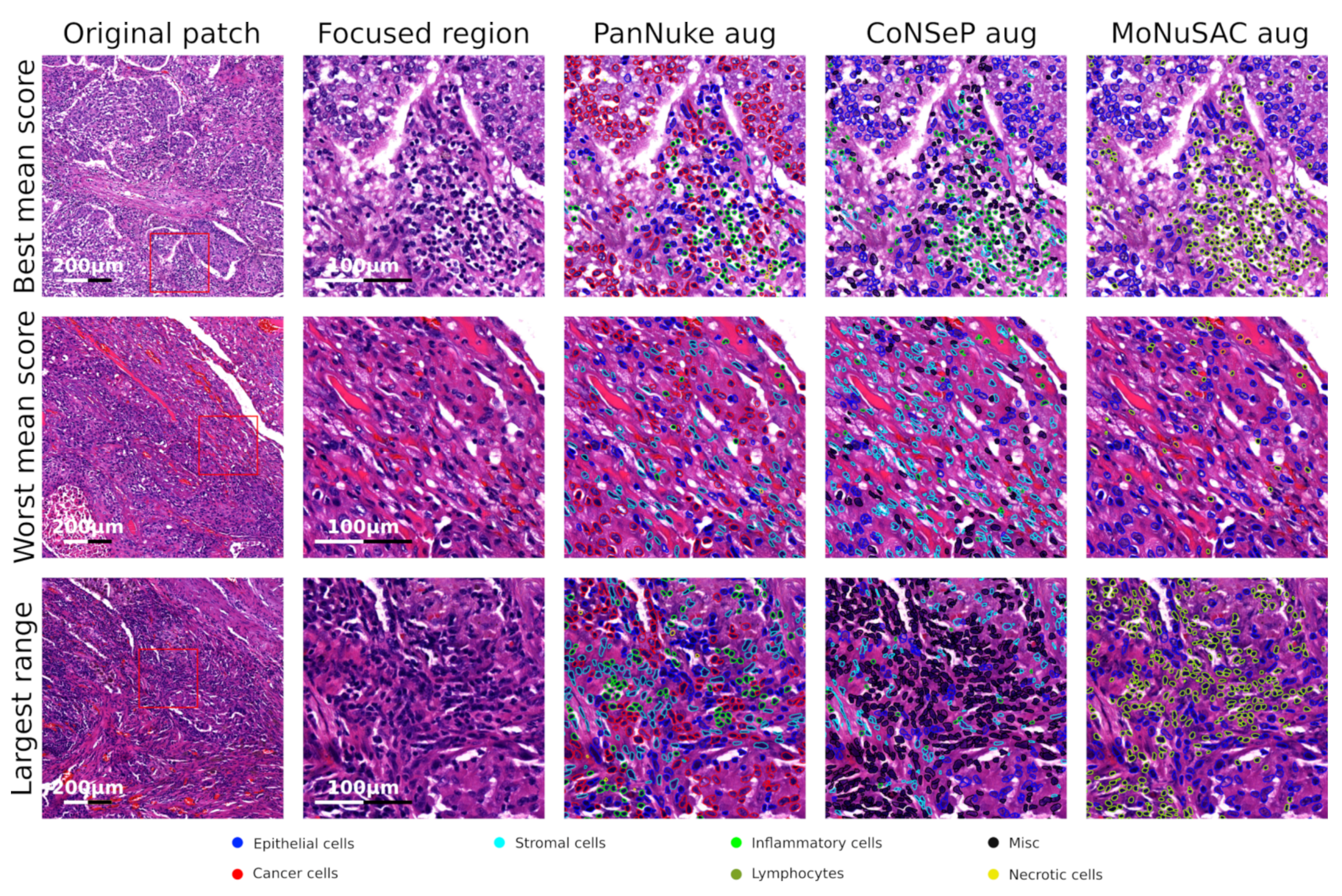 Cancers 14 02974 g005