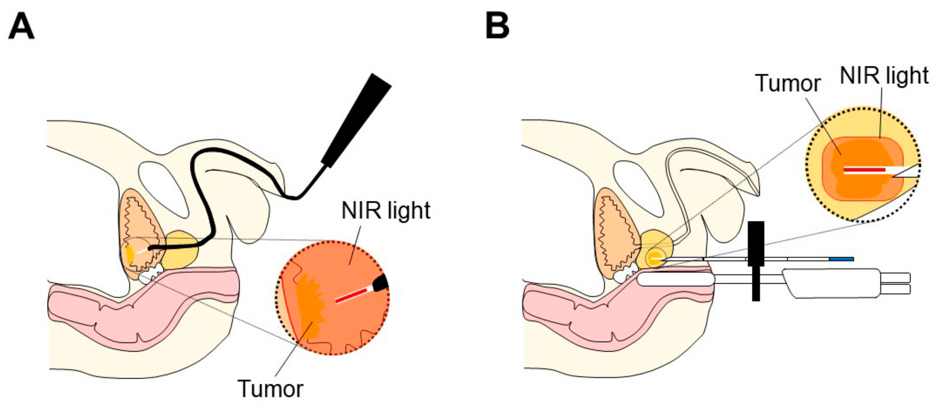 Cancers 14 02996 g002