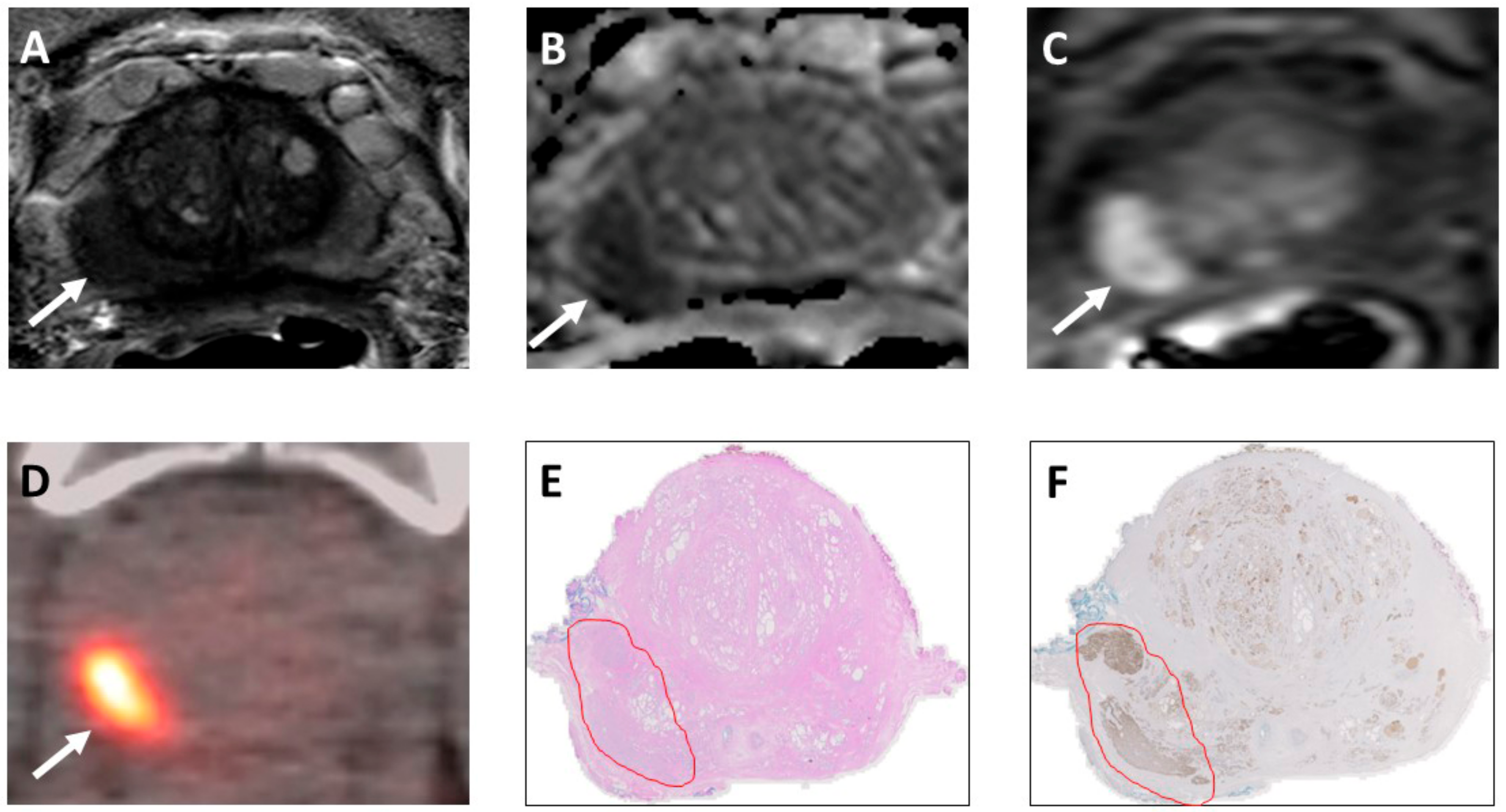 Cancers 14 02996 g003