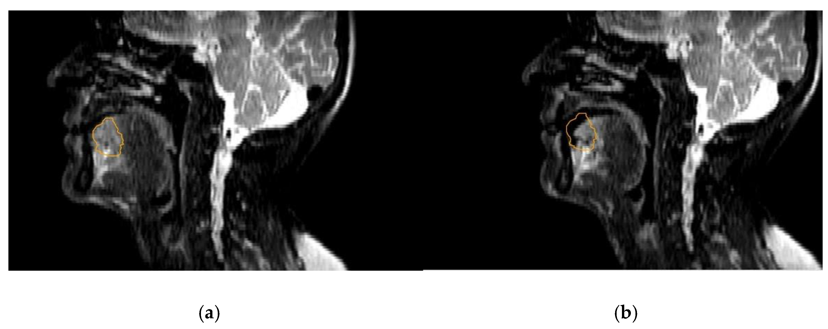 Cancers 14 03027 g003