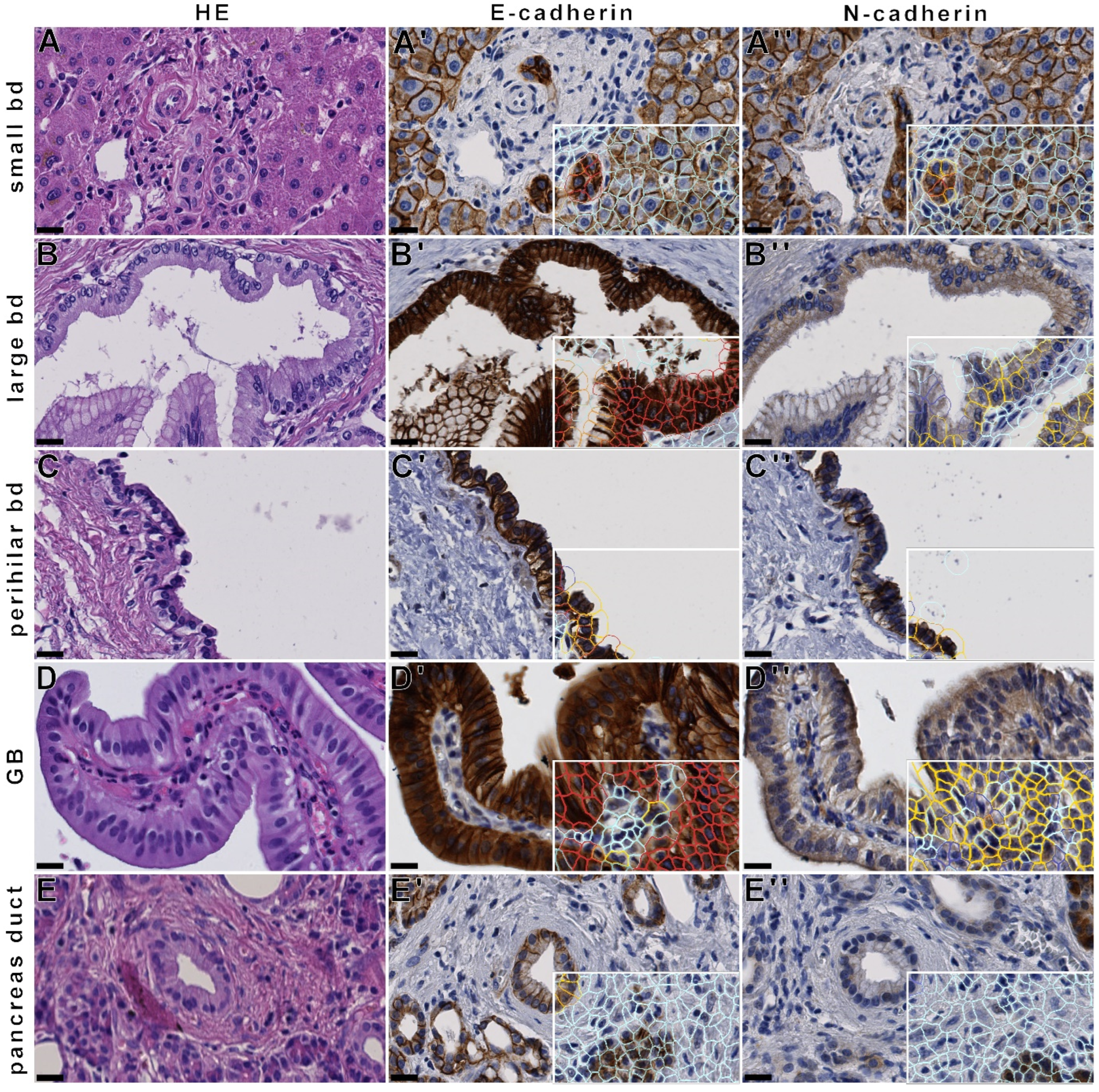 Cancers 14 03091 g002