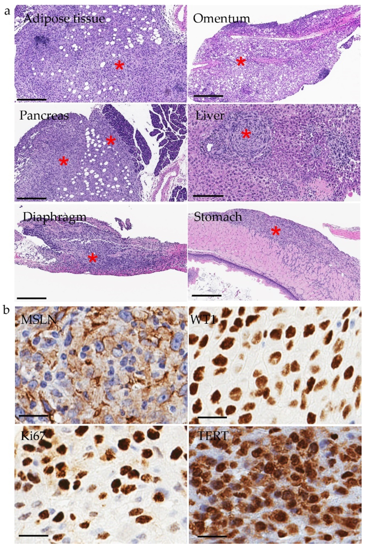 Cancers 14 03108 g002 Cancers 14 03108 g002