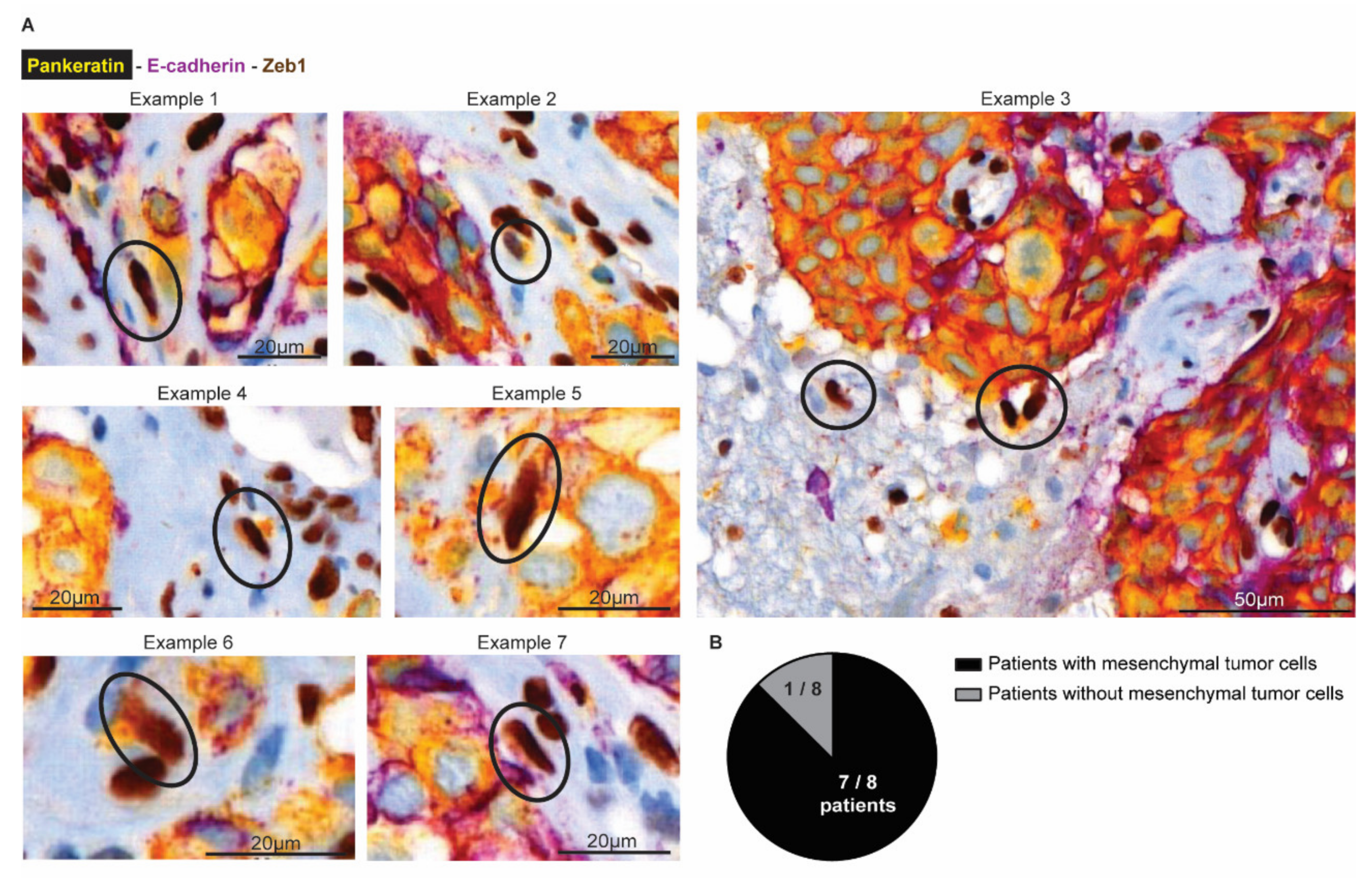 Cancers 14 03115 g007