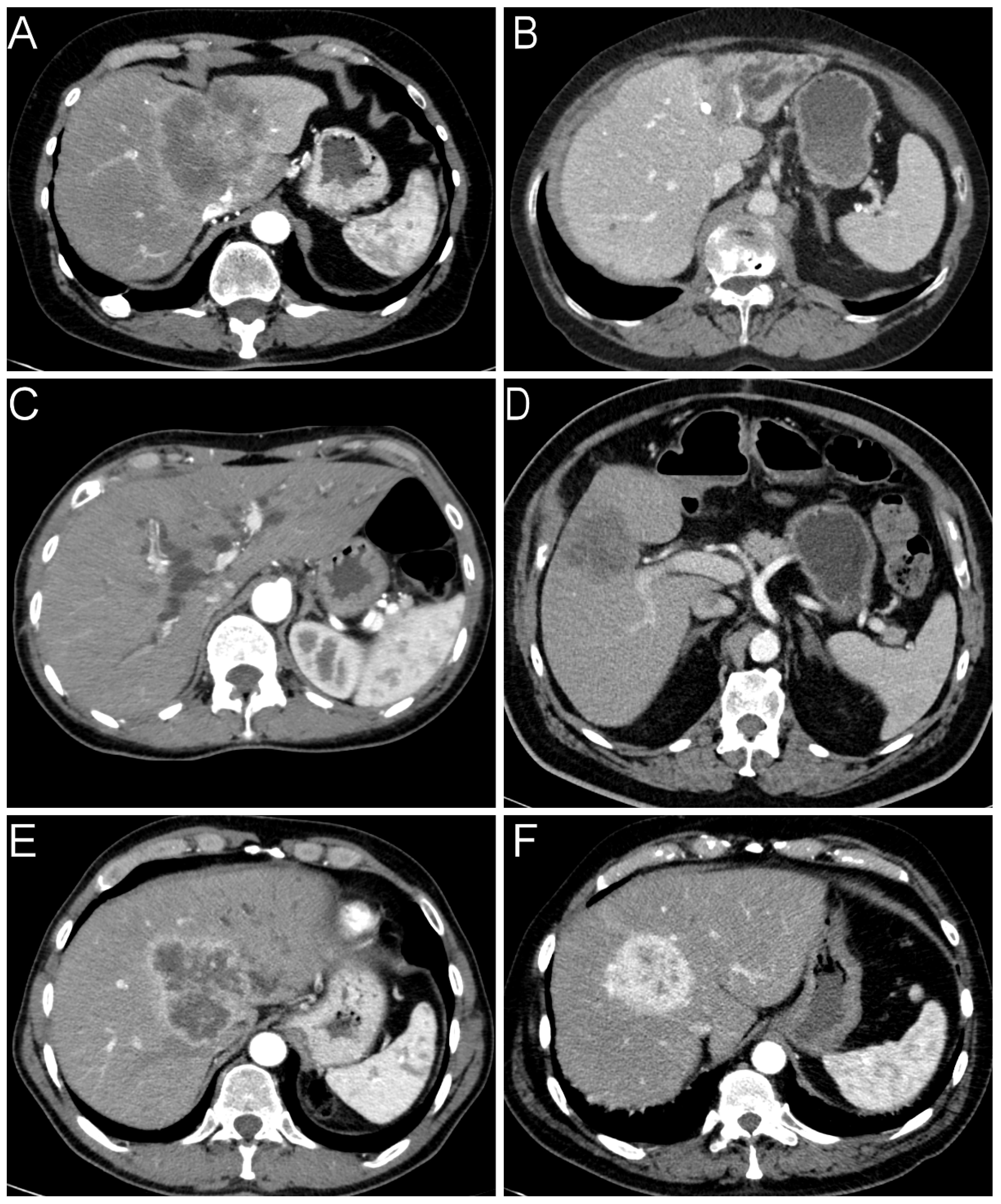 Cancers 14 03156 g001