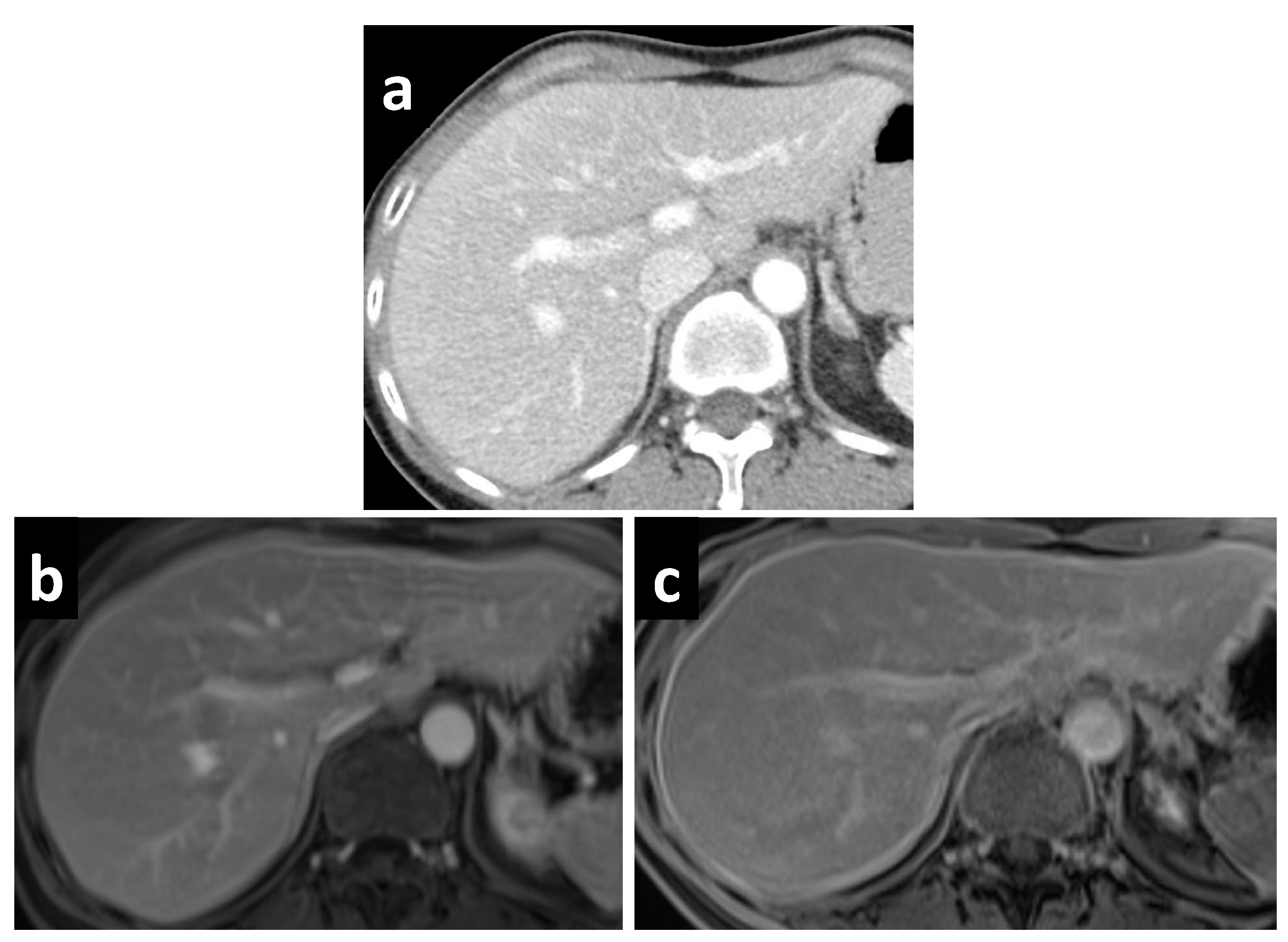 Cancers 14 03179 g004 Cancers 14 03179 g004