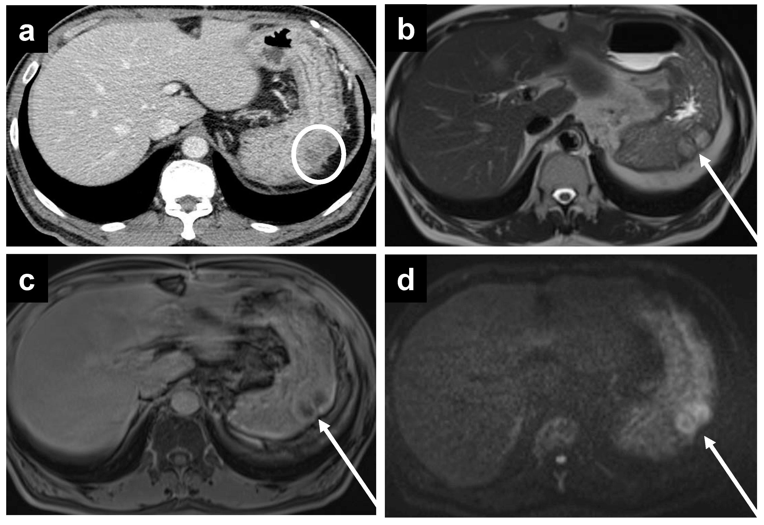 Cancers 14 03179 g005 Cancers 14 03179 g005