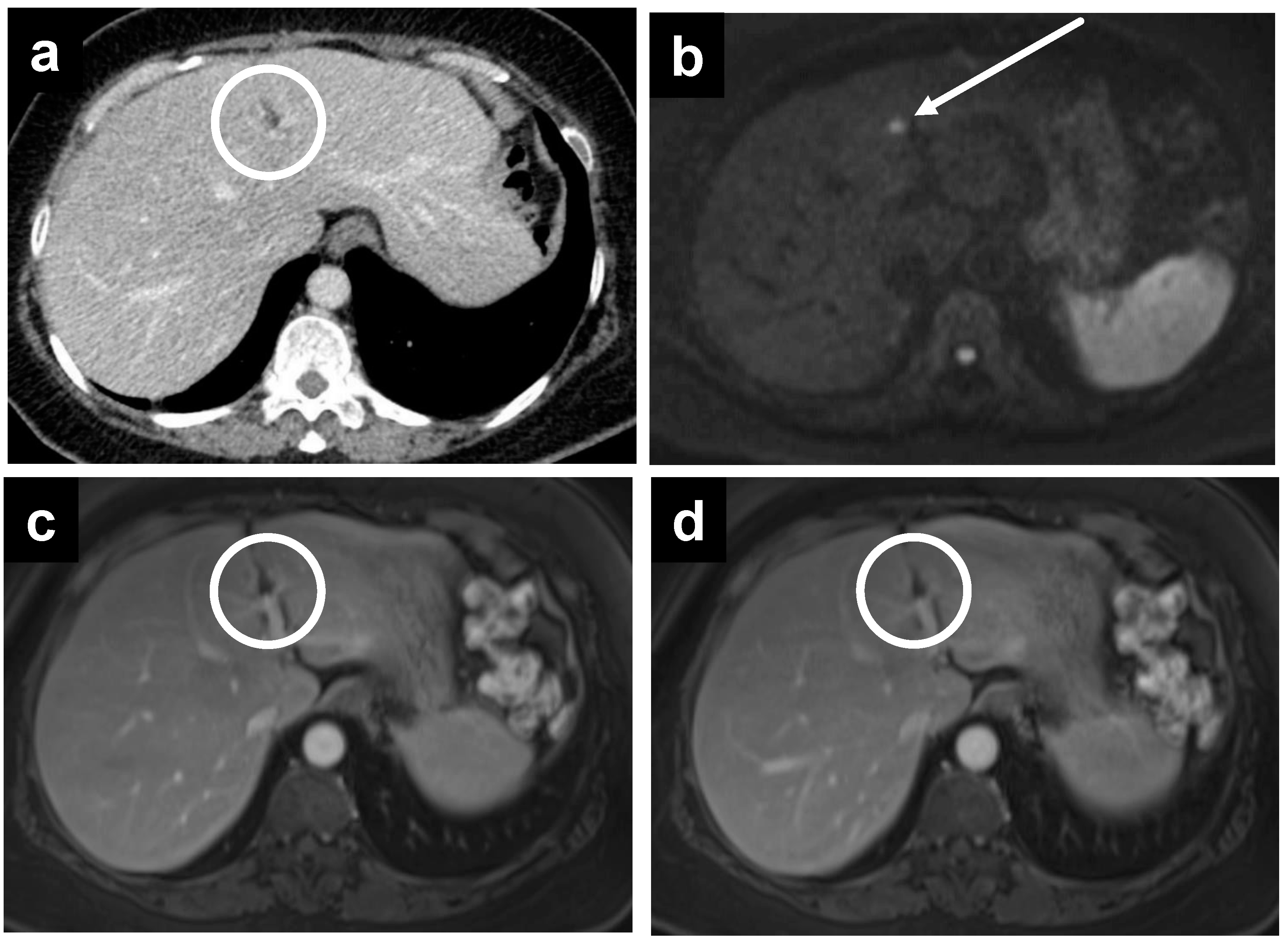 Cancers 14 03179 g006 Cancers 14 03179 g006