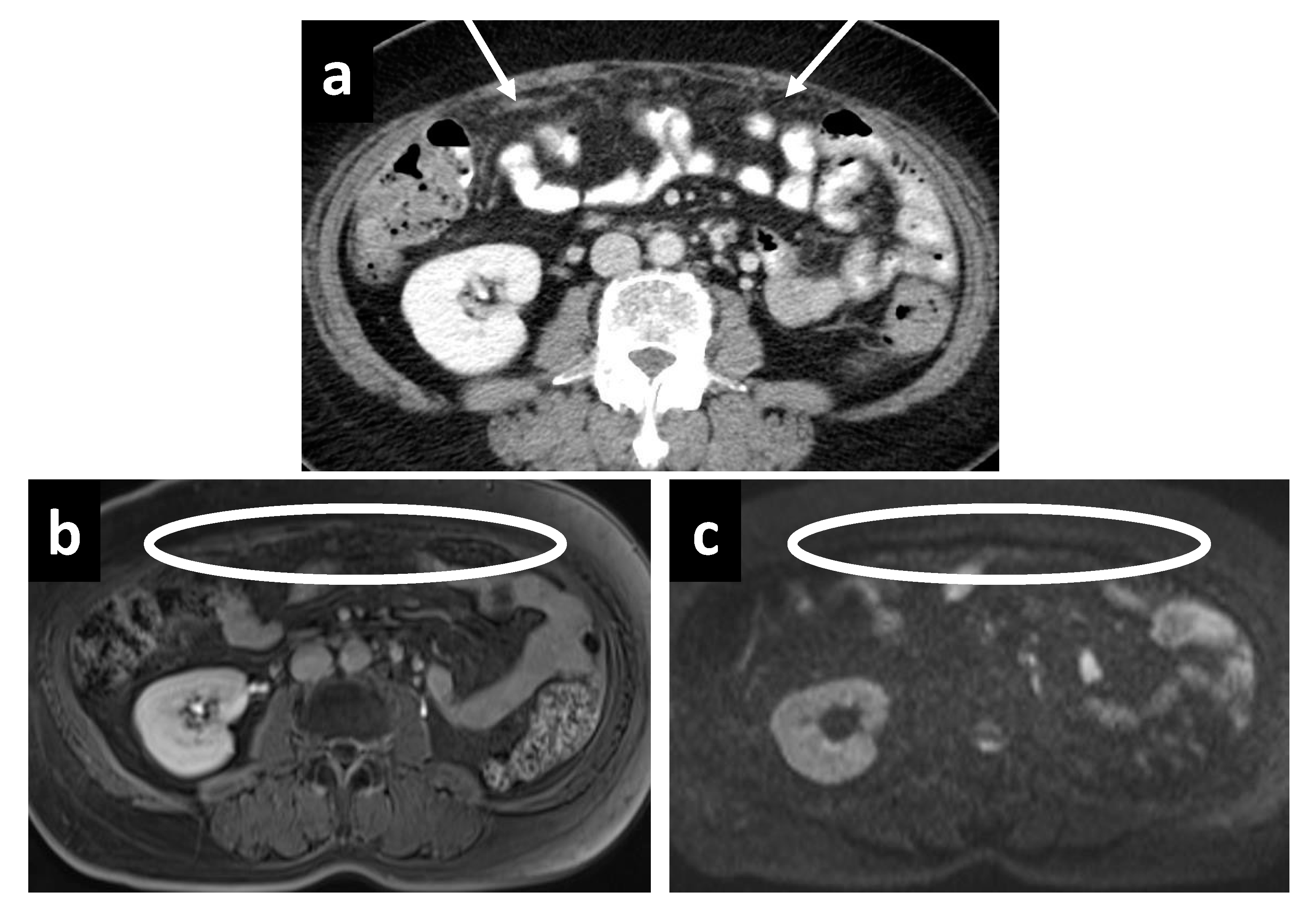 Cancers 14 03179 g008 Cancers 14 03179 g008