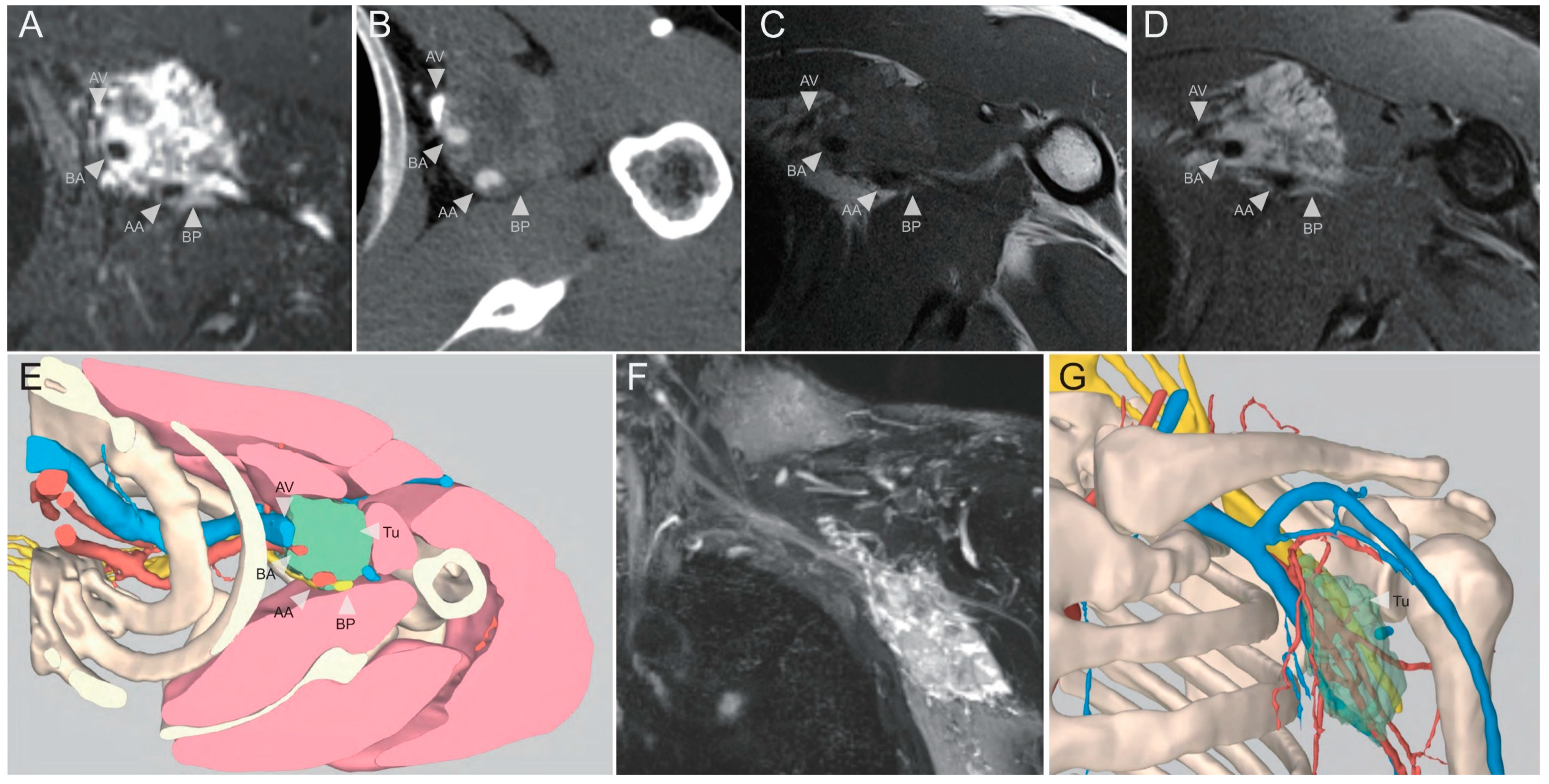 Cancers 14 03185 g002