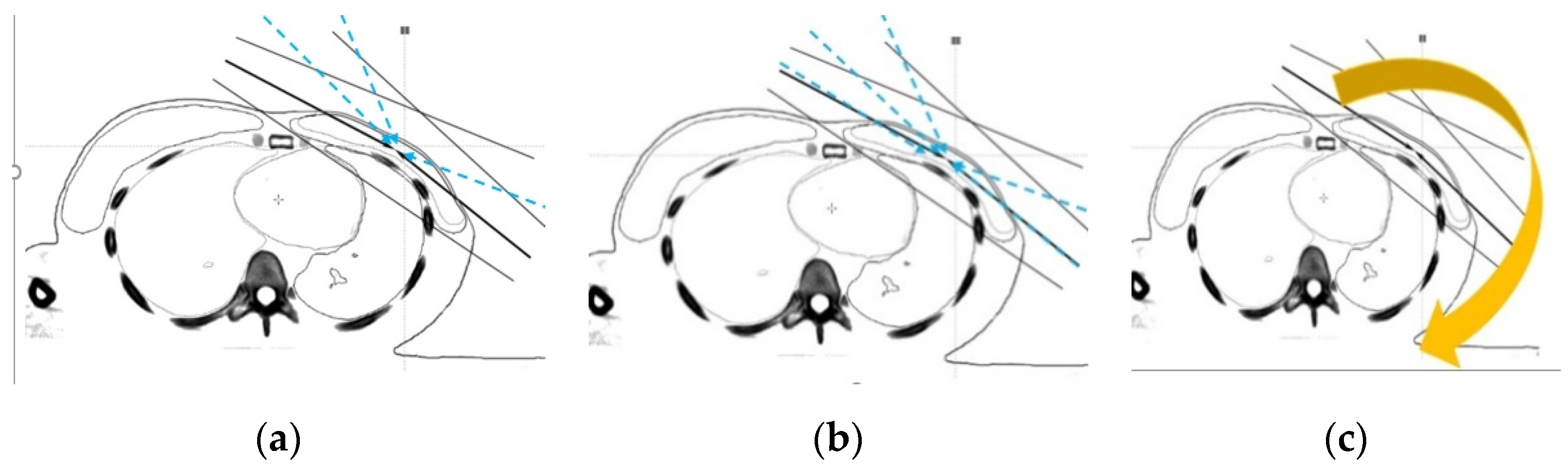 Cancers 14 03205 g003