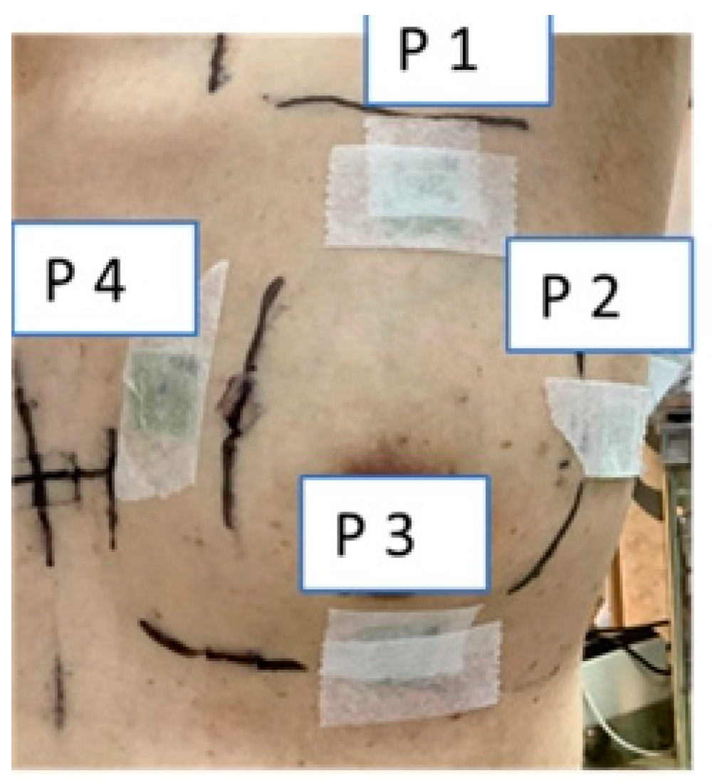 Cancers 14 03205 g005