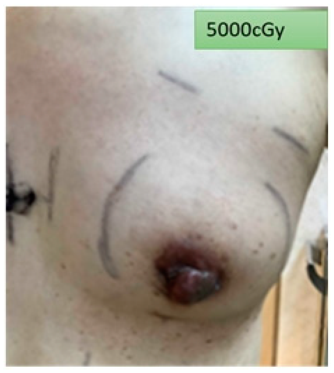 Cancers 14 03205 g008