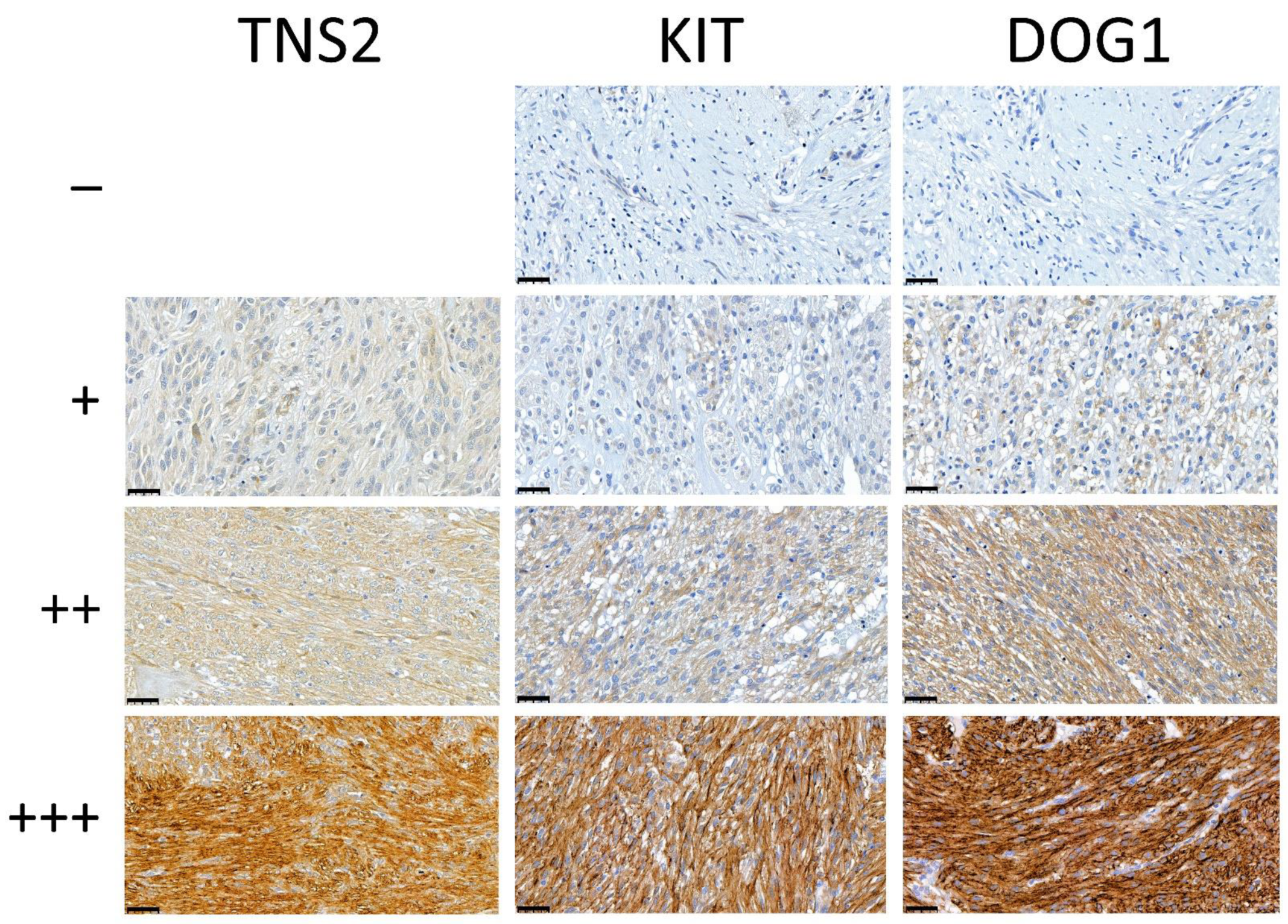 Cancers 14 03212 g002