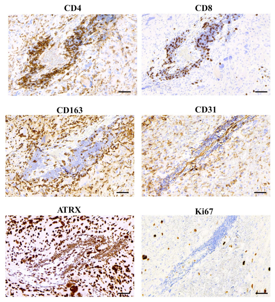 Cancers 14 03249 g002