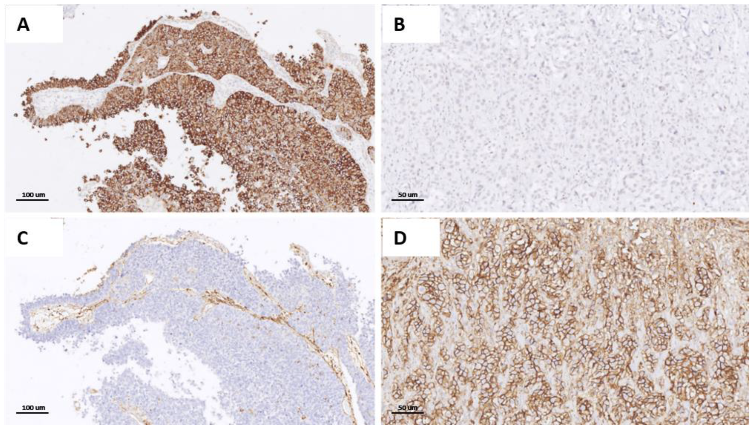 Cancers 14 03256 g004