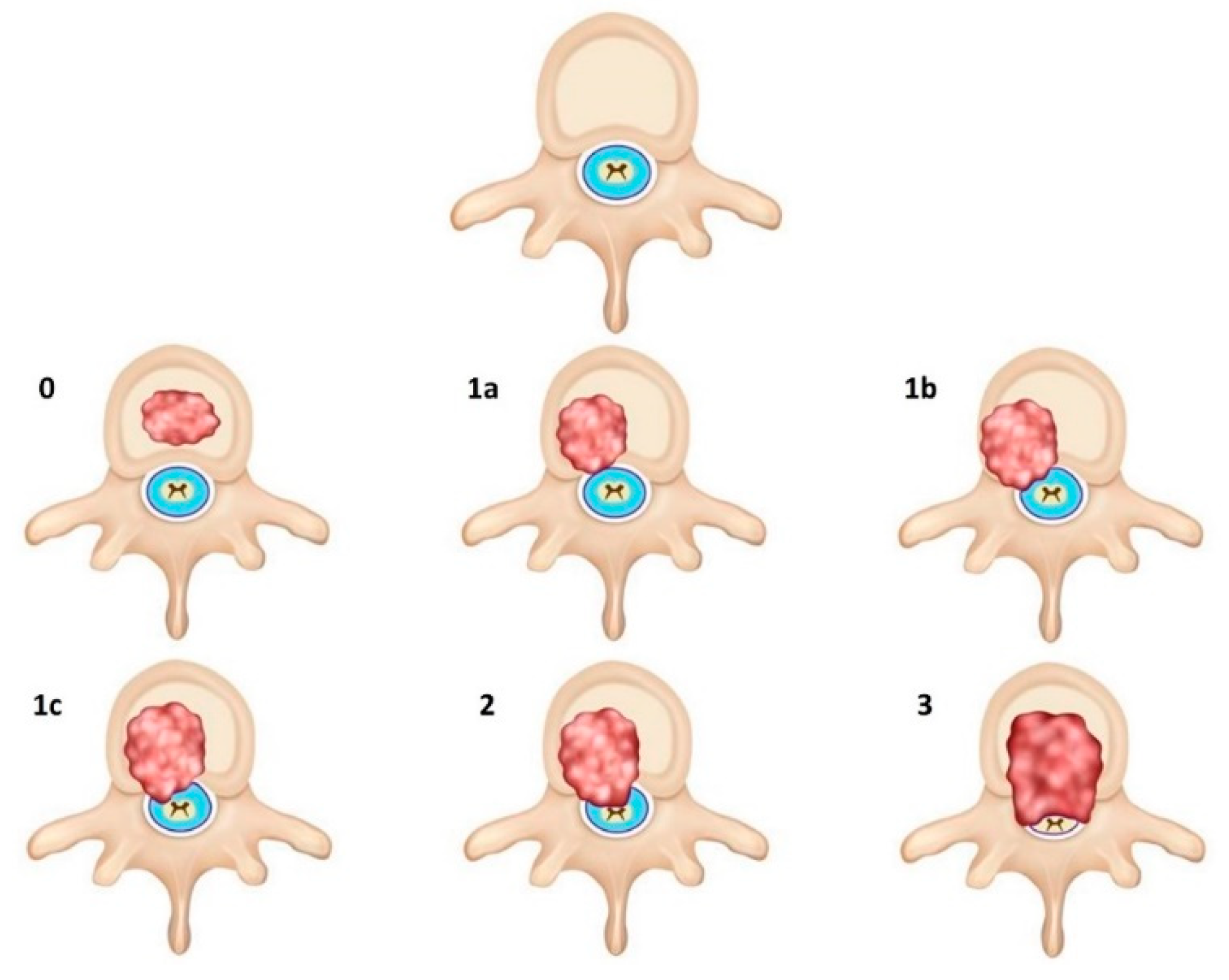 Cancers 14 03289 g001