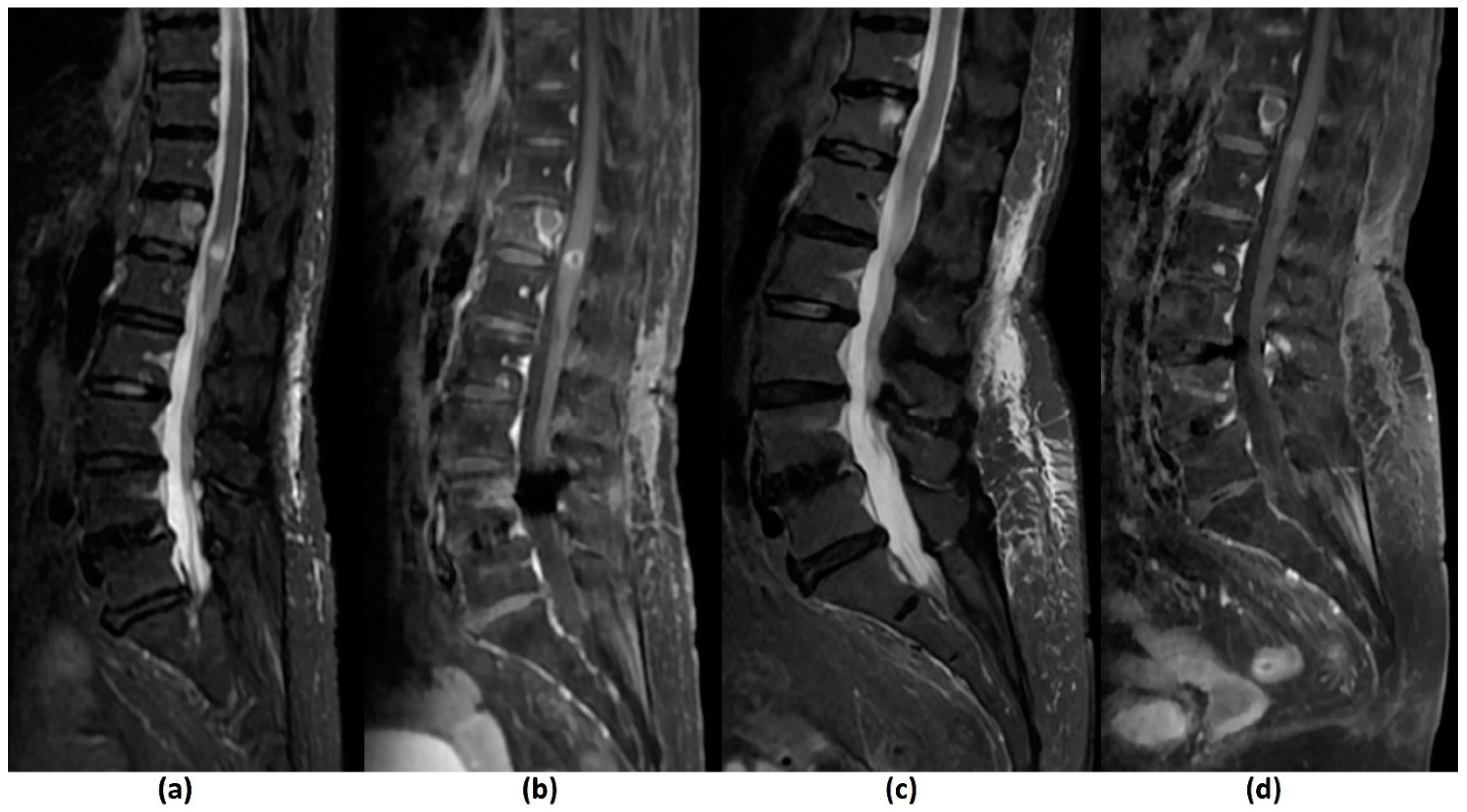 Cancers 14 03289 g011a