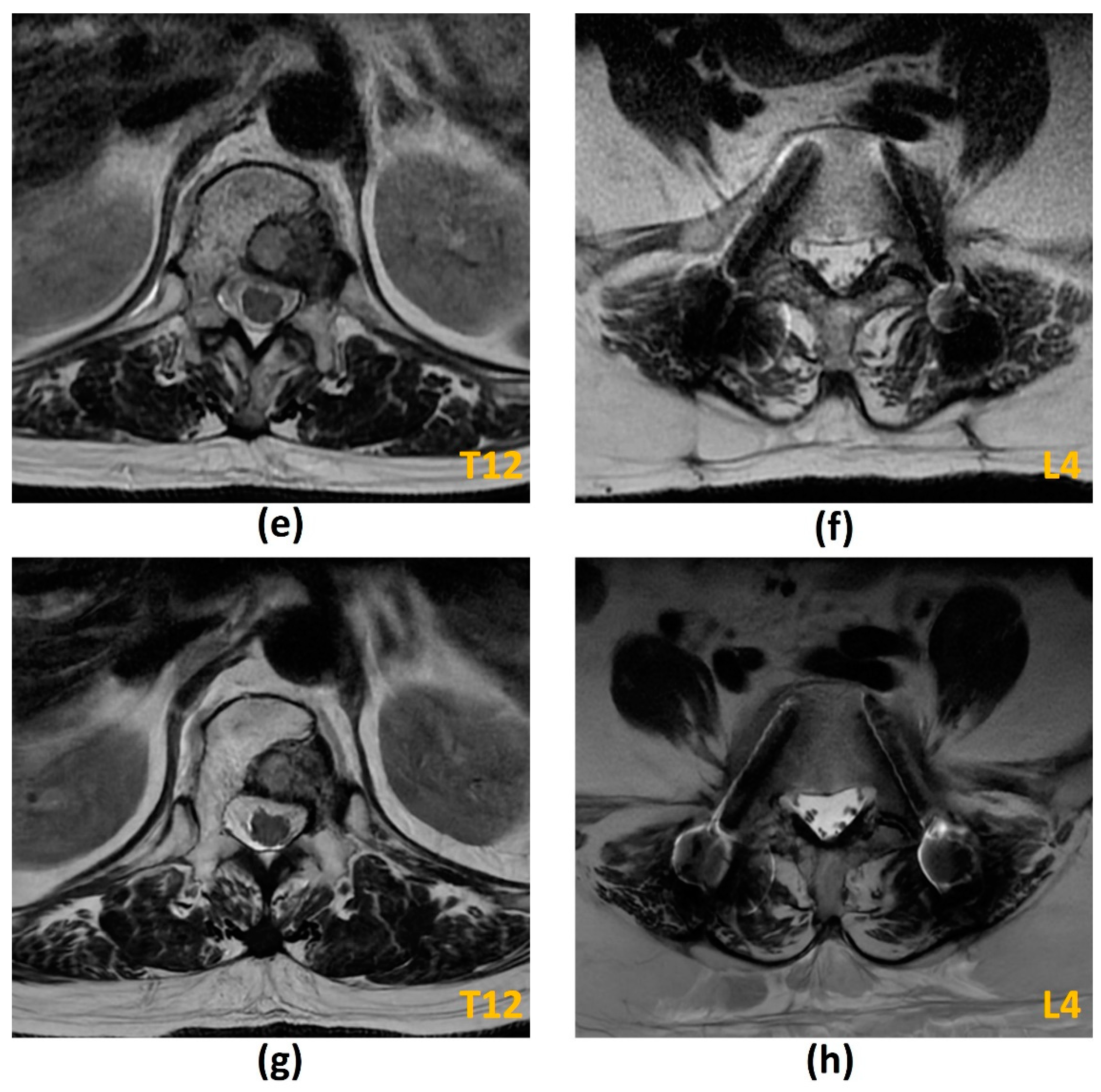 Cancers 14 03289 g011b