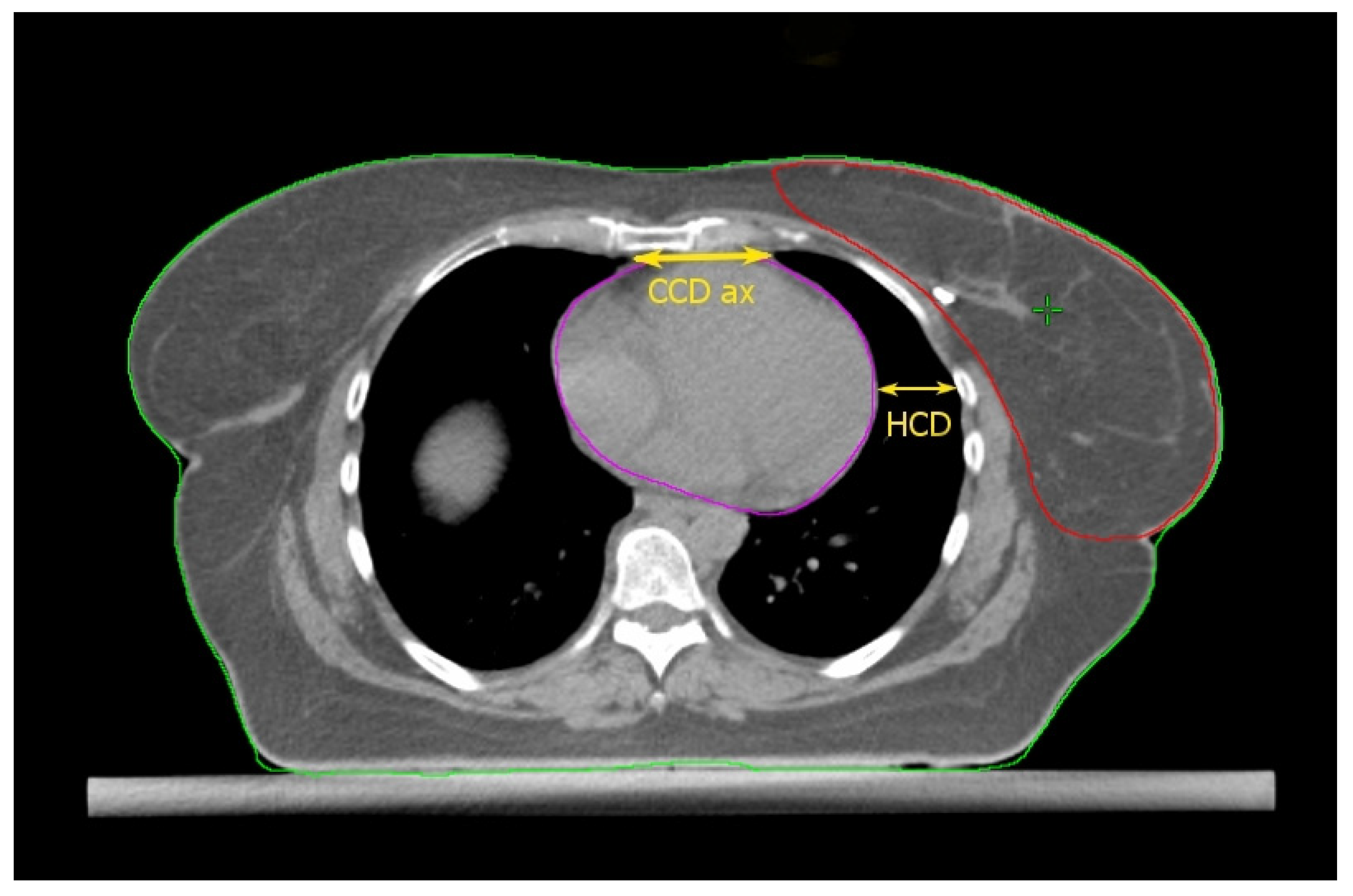 Cancers 14 03477 g001