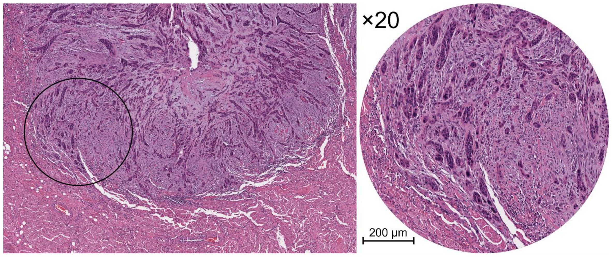 Cancers 14 03571 g001