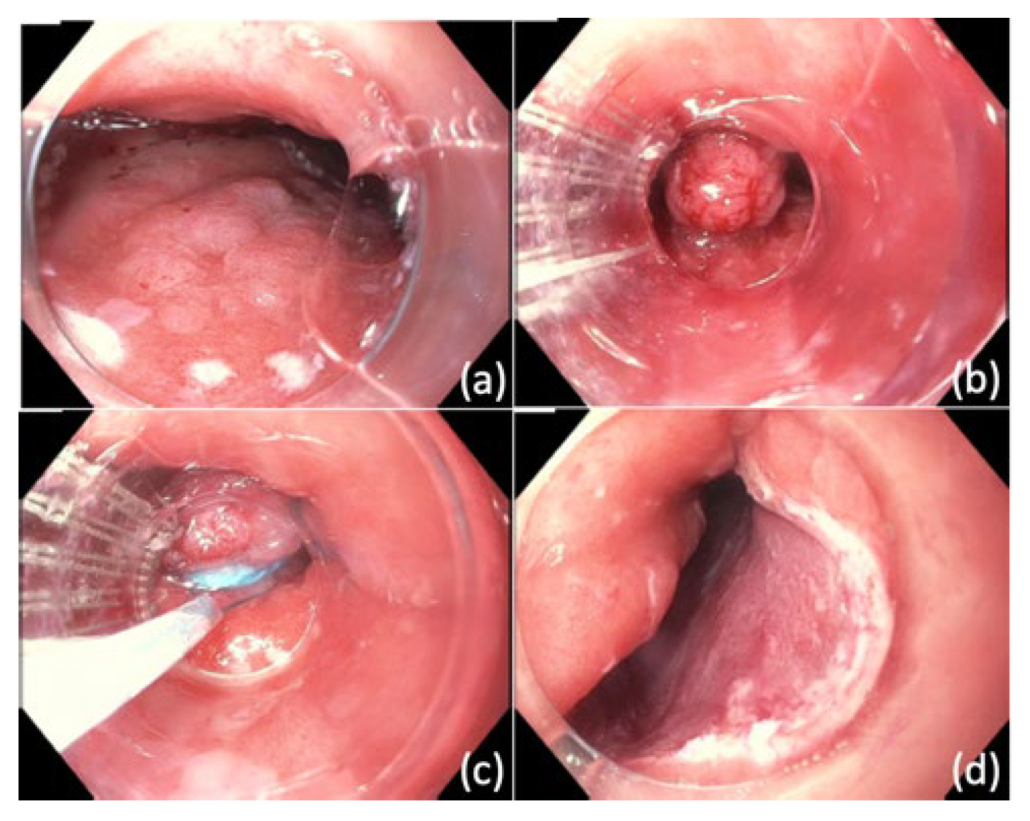 Cancers 14 03583 g001 Cancers 14 03583 g001