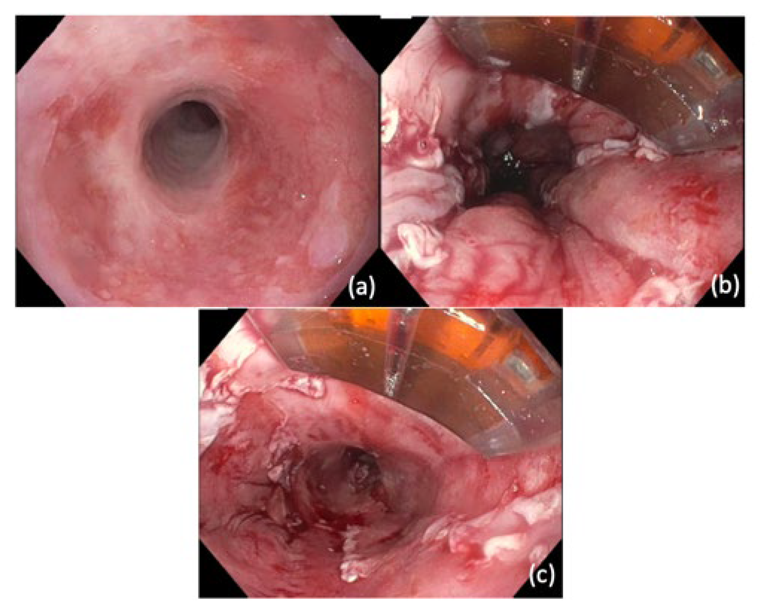 Cancers 14 03583 g003 Cancers 14 03583 g003