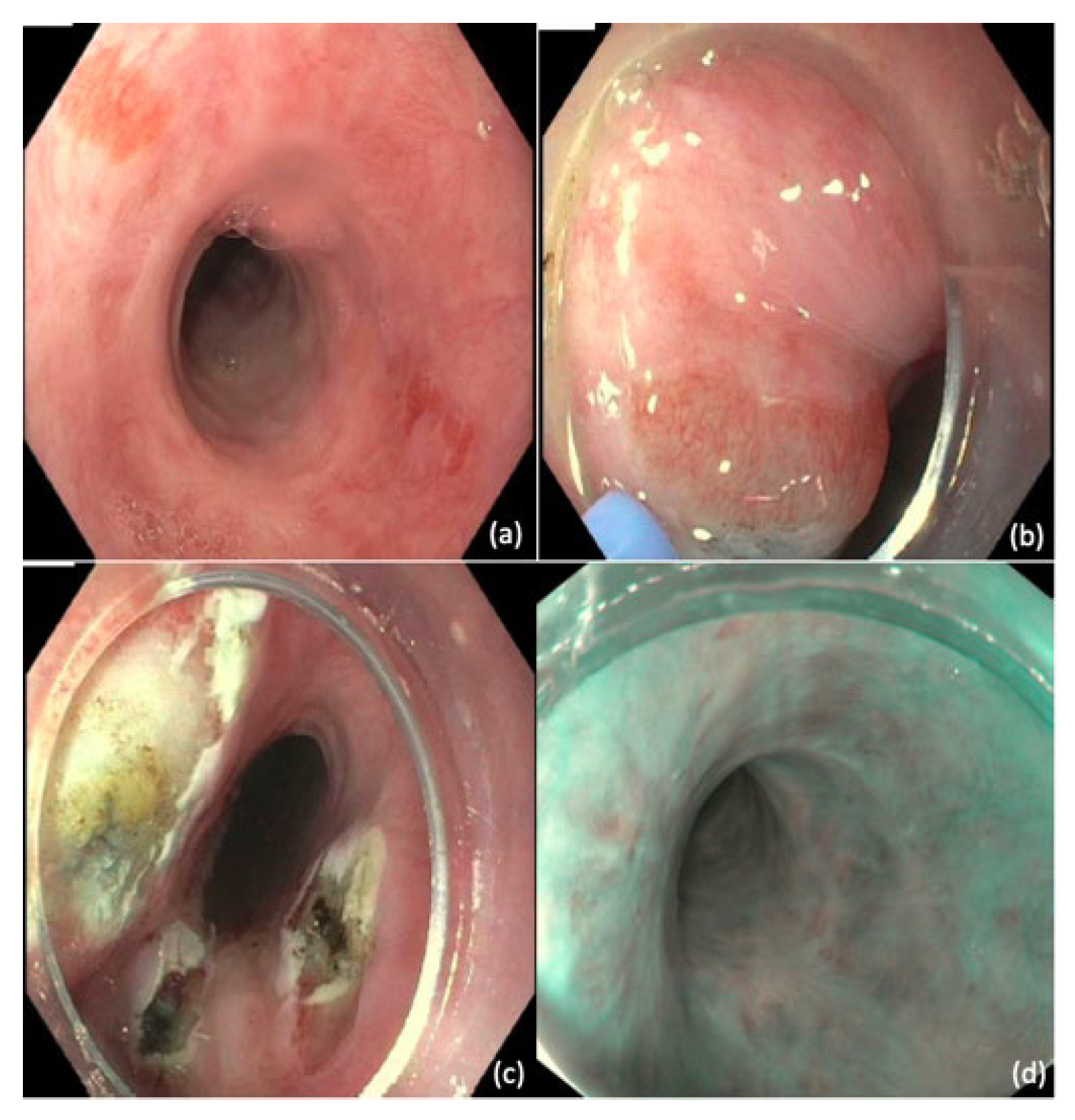 Cancers 14 03583 g004 Cancers 14 03583 g004