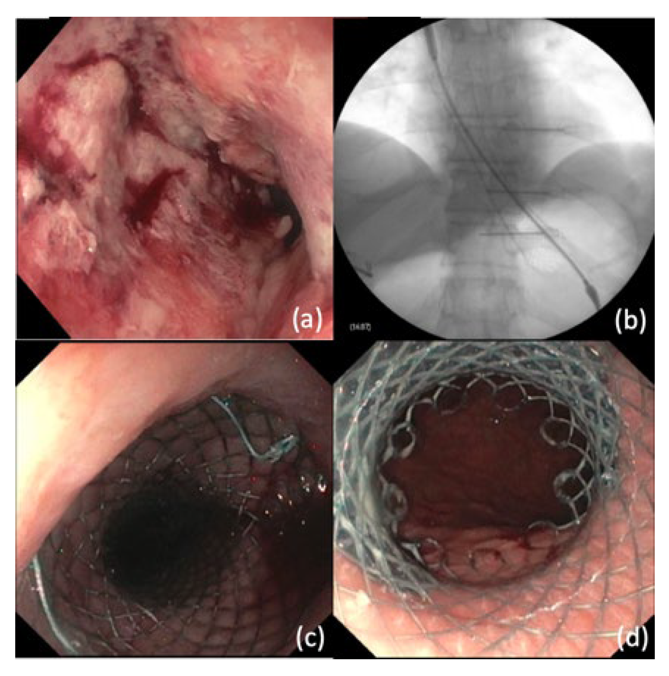 Cancers 14 03583 g005 Cancers 14 03583 g005
