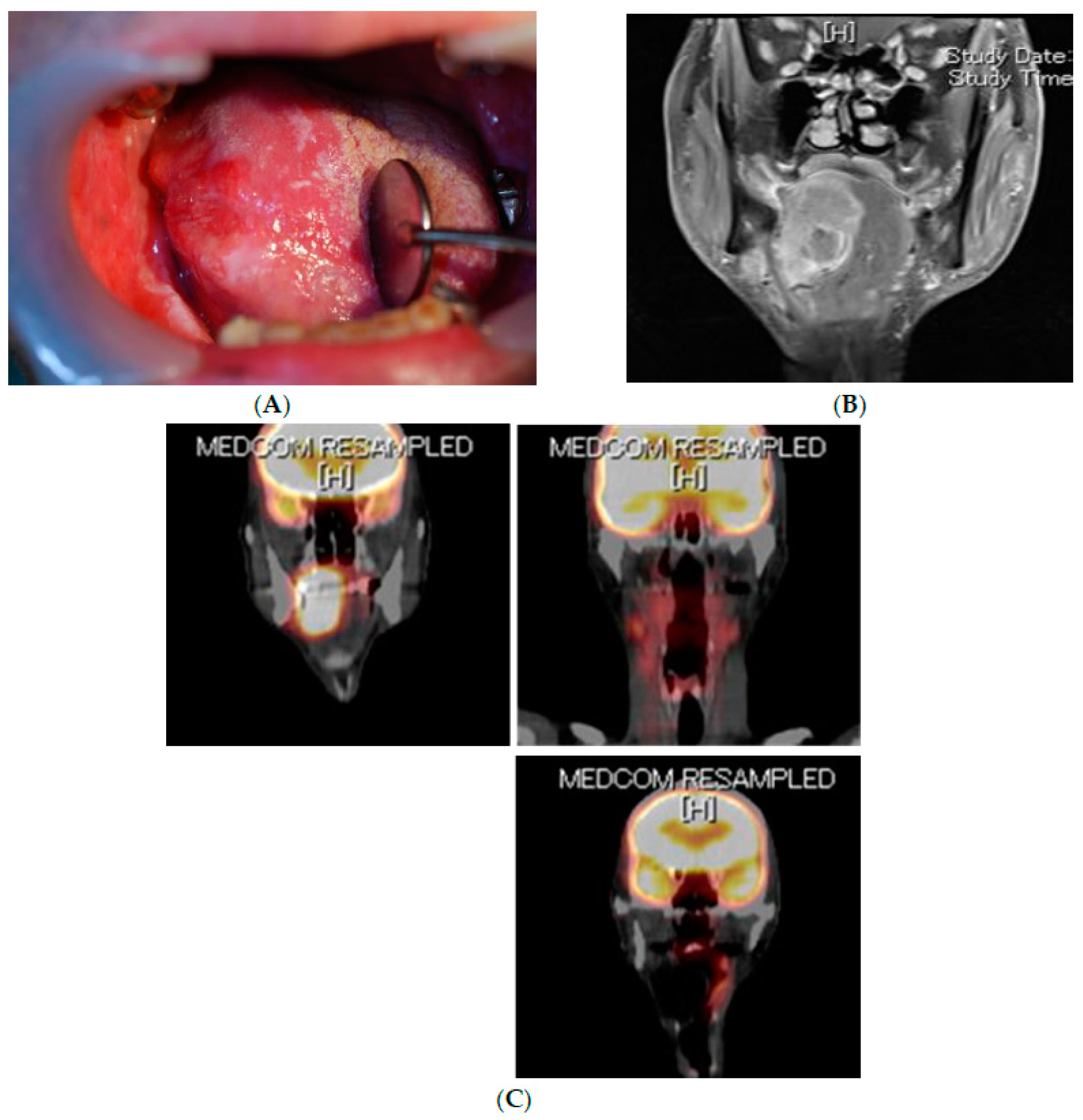 Cancers 14 03588 g002