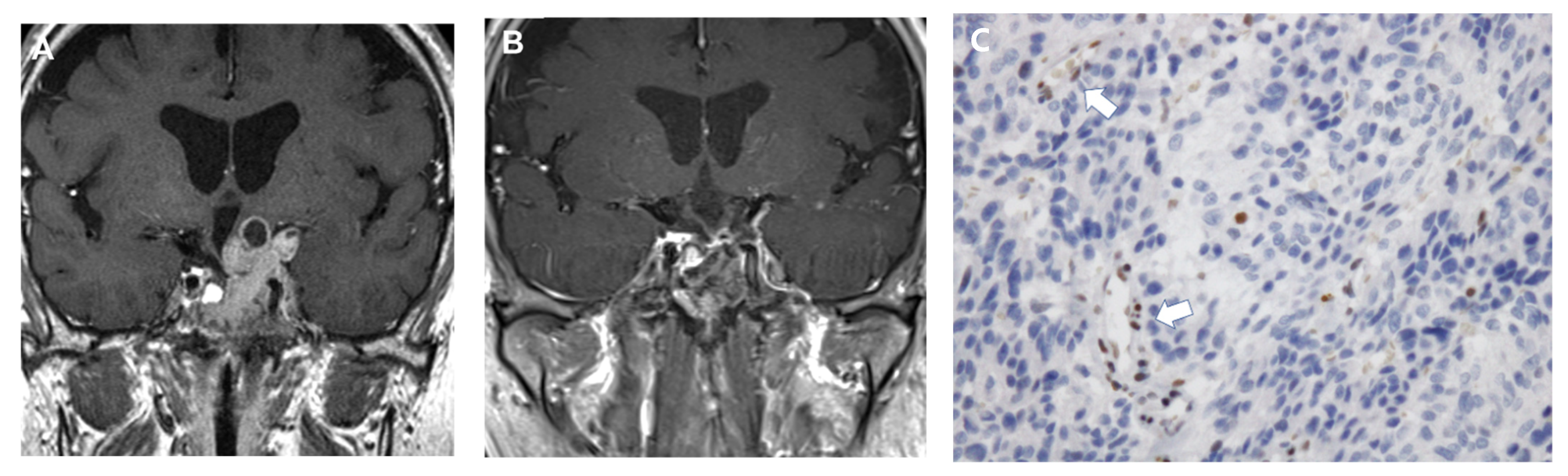 Cancers 14 03604 g002