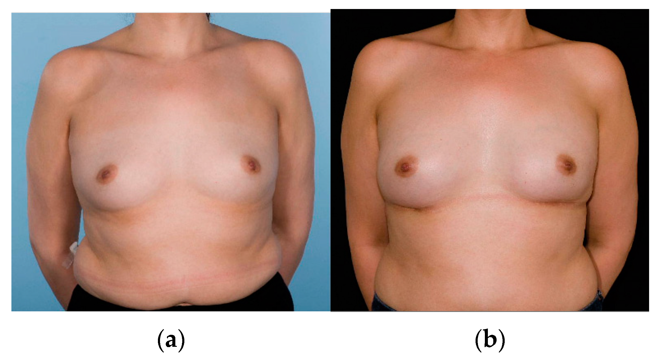 Cancers 14 03607 g001