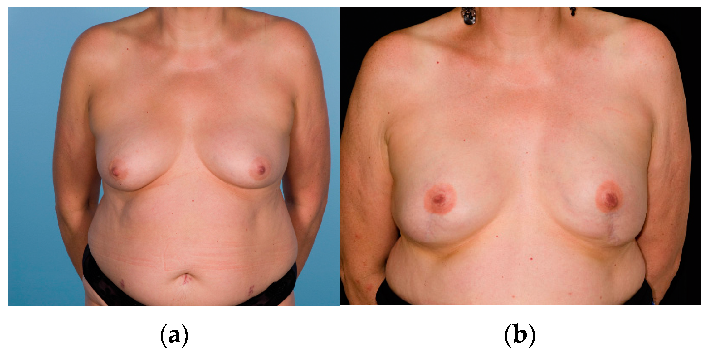 Cancers 14 03607 g002