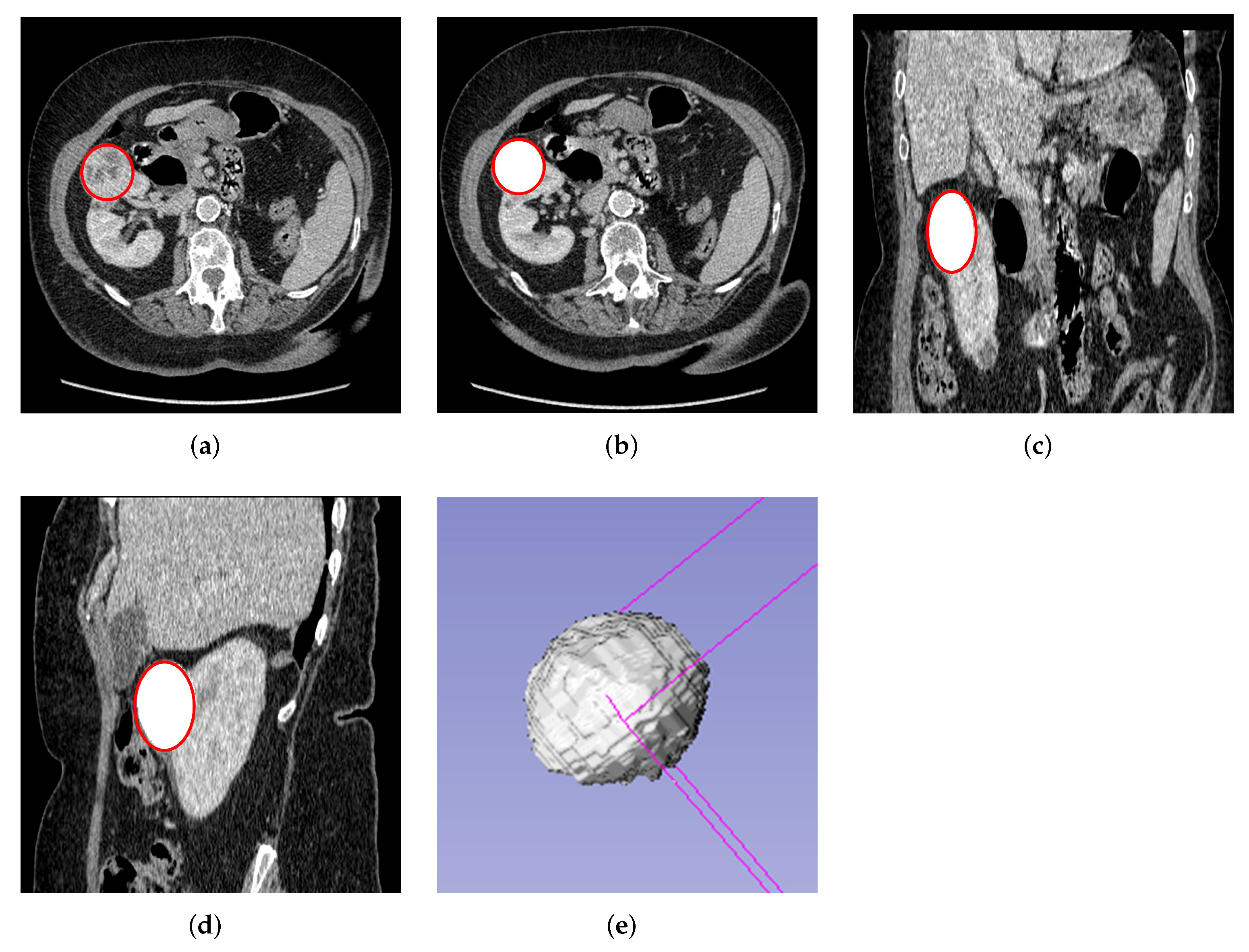 Cancers 14 03609 g002 Cancers 14 03609 g002