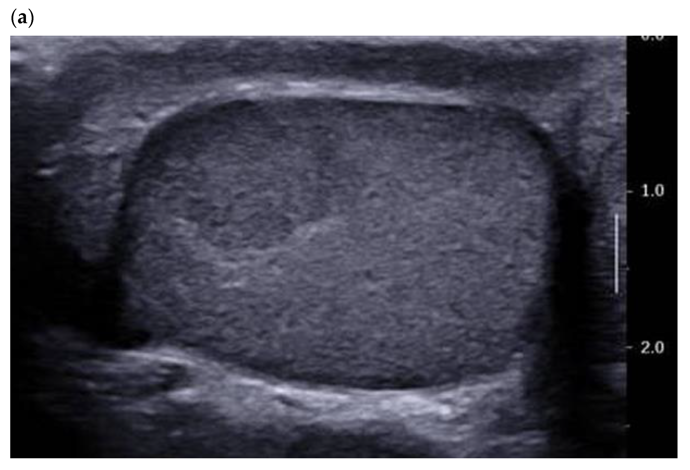 Cancers 14 03652 g001a Cancers 14 03652 g001a