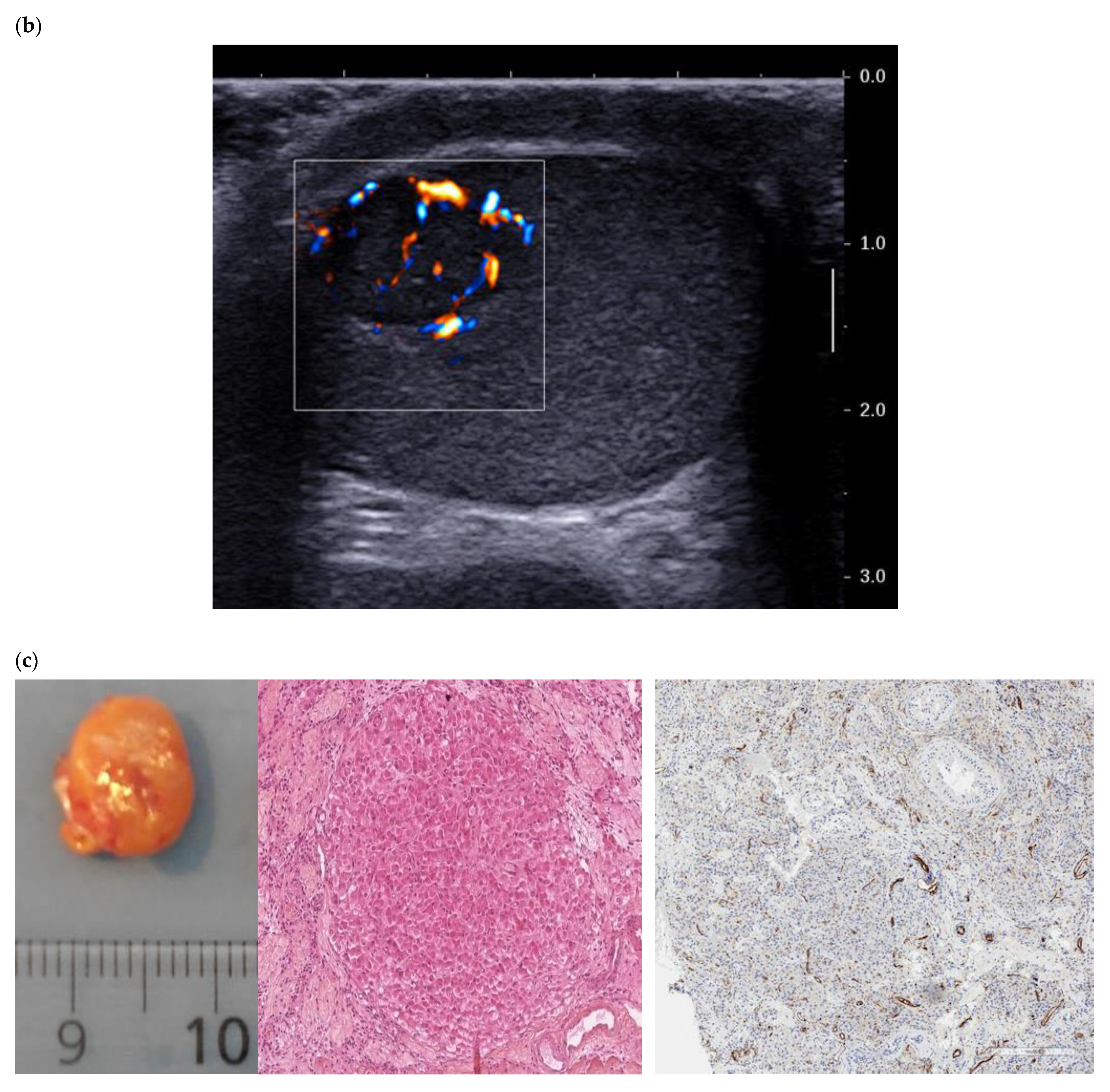 Cancers 14 03652 g001b Cancers 14 03652 g001b