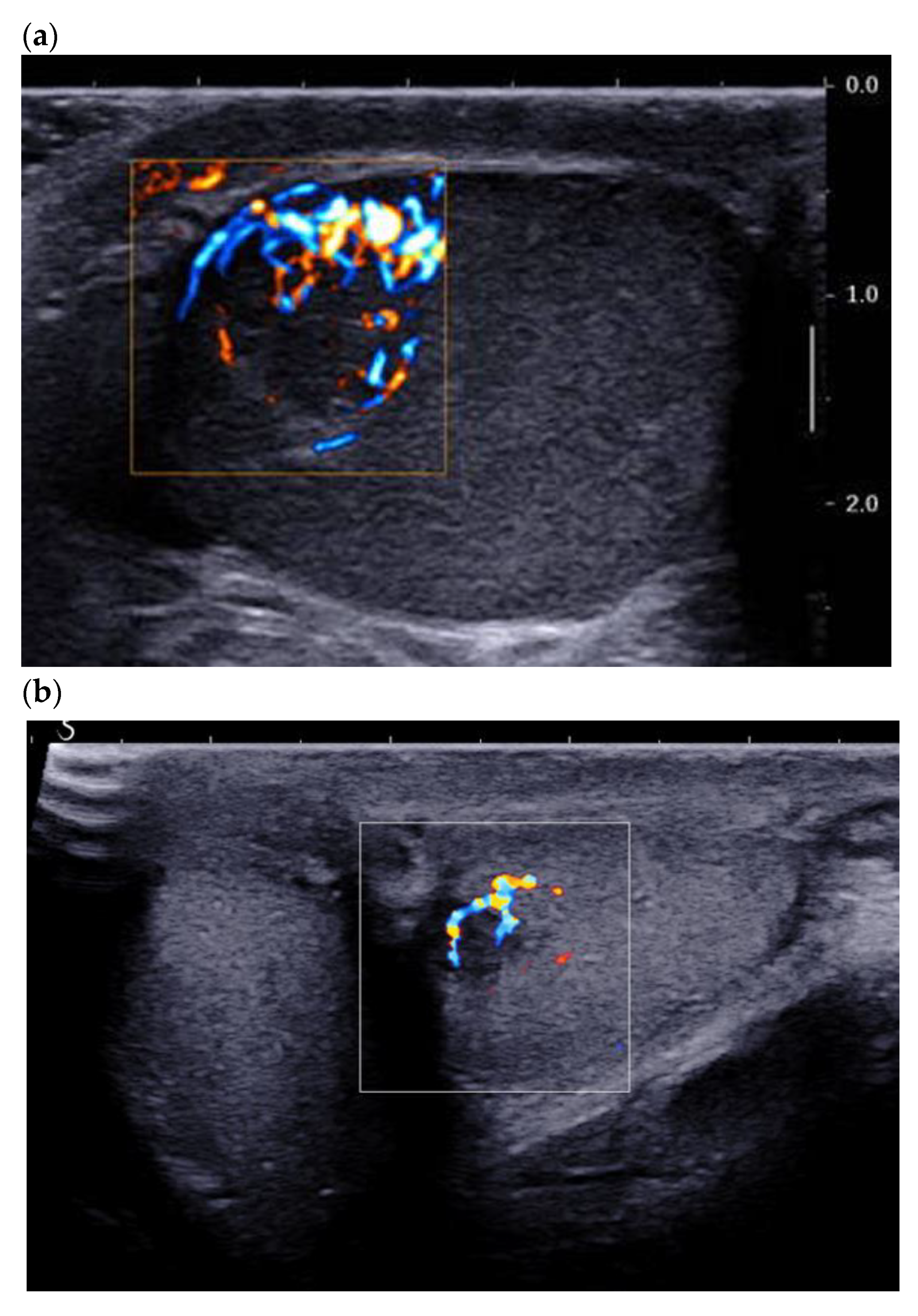 Cancers 14 03652 g002 Cancers 14 03652 g002