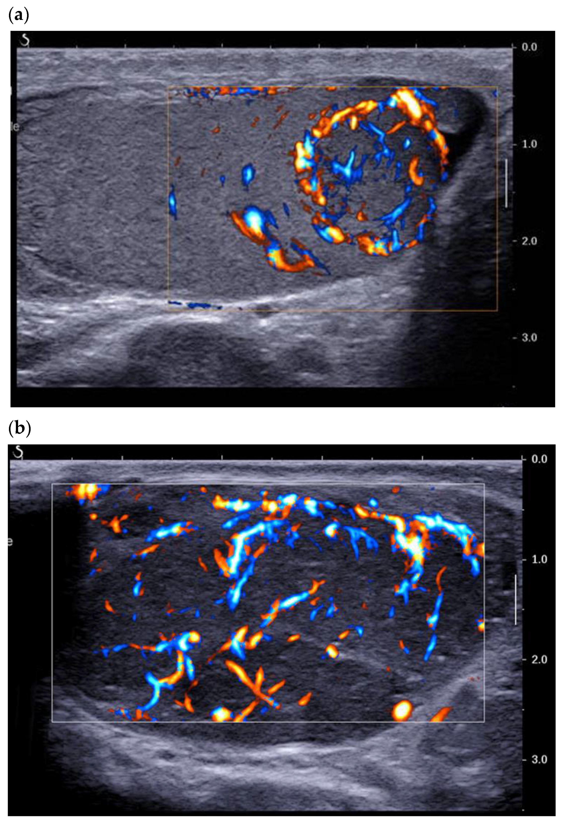 Cancers 14 03652 g003 Cancers 14 03652 g003