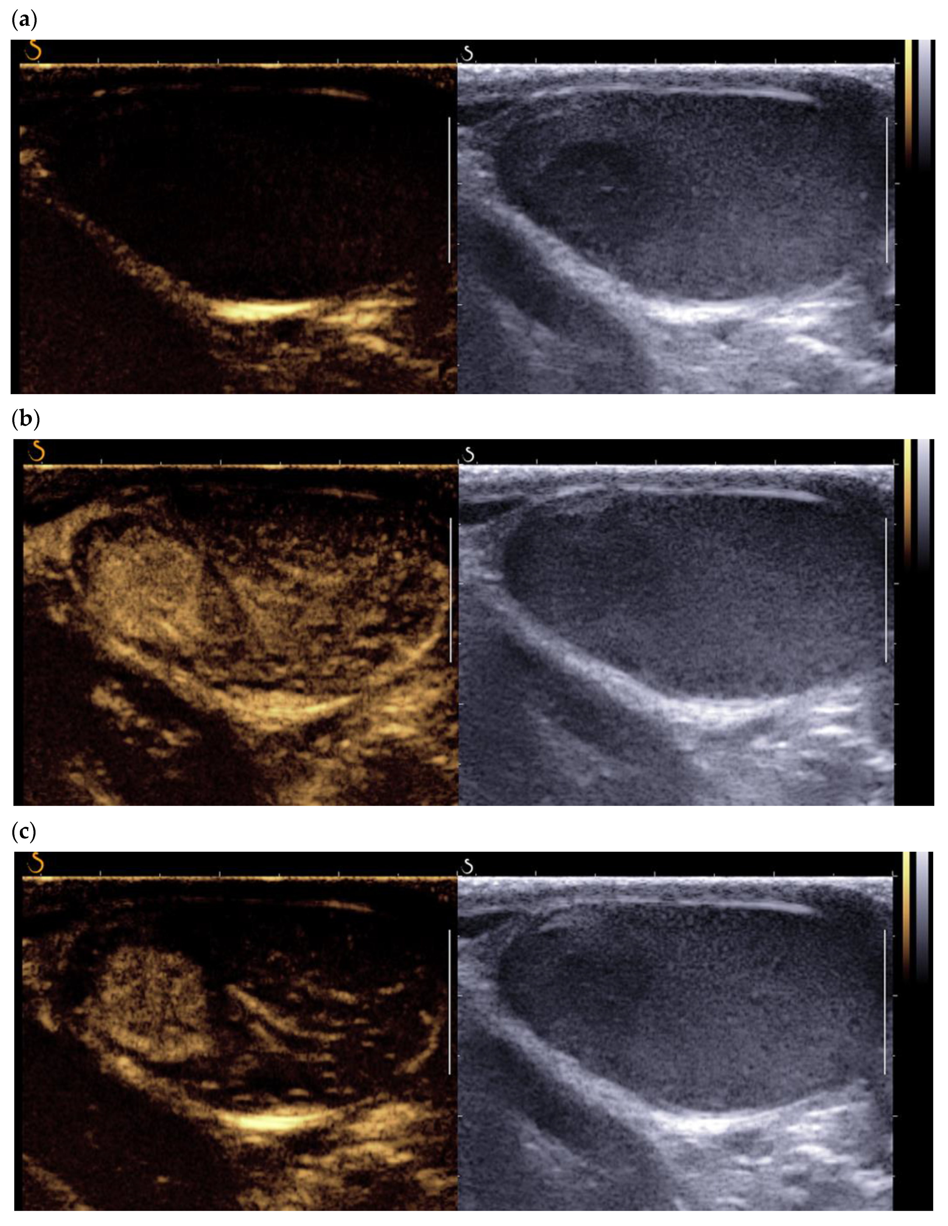 Cancers 14 03652 g004 Cancers 14 03652 g004