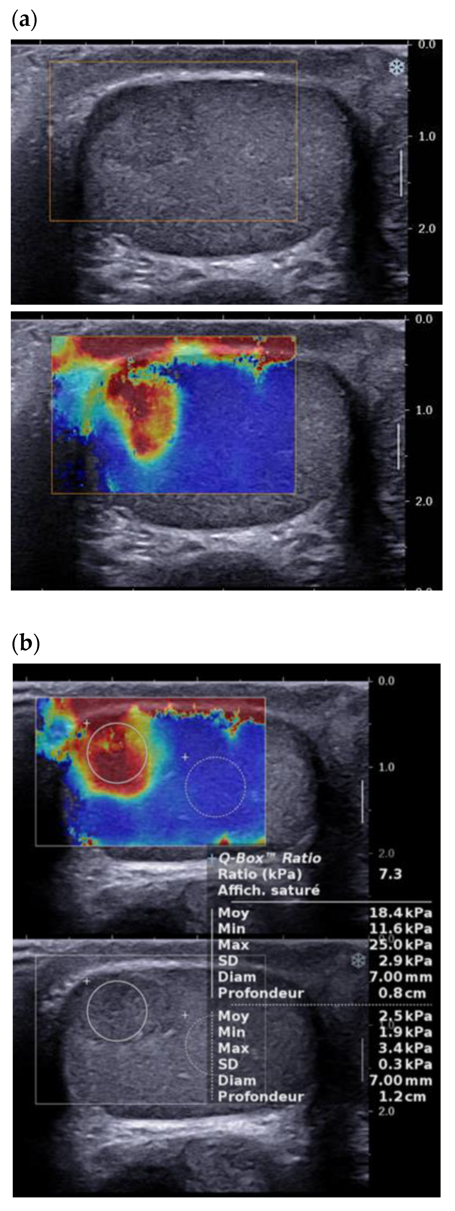 Cancers 14 03652 g005 Cancers 14 03652 g005