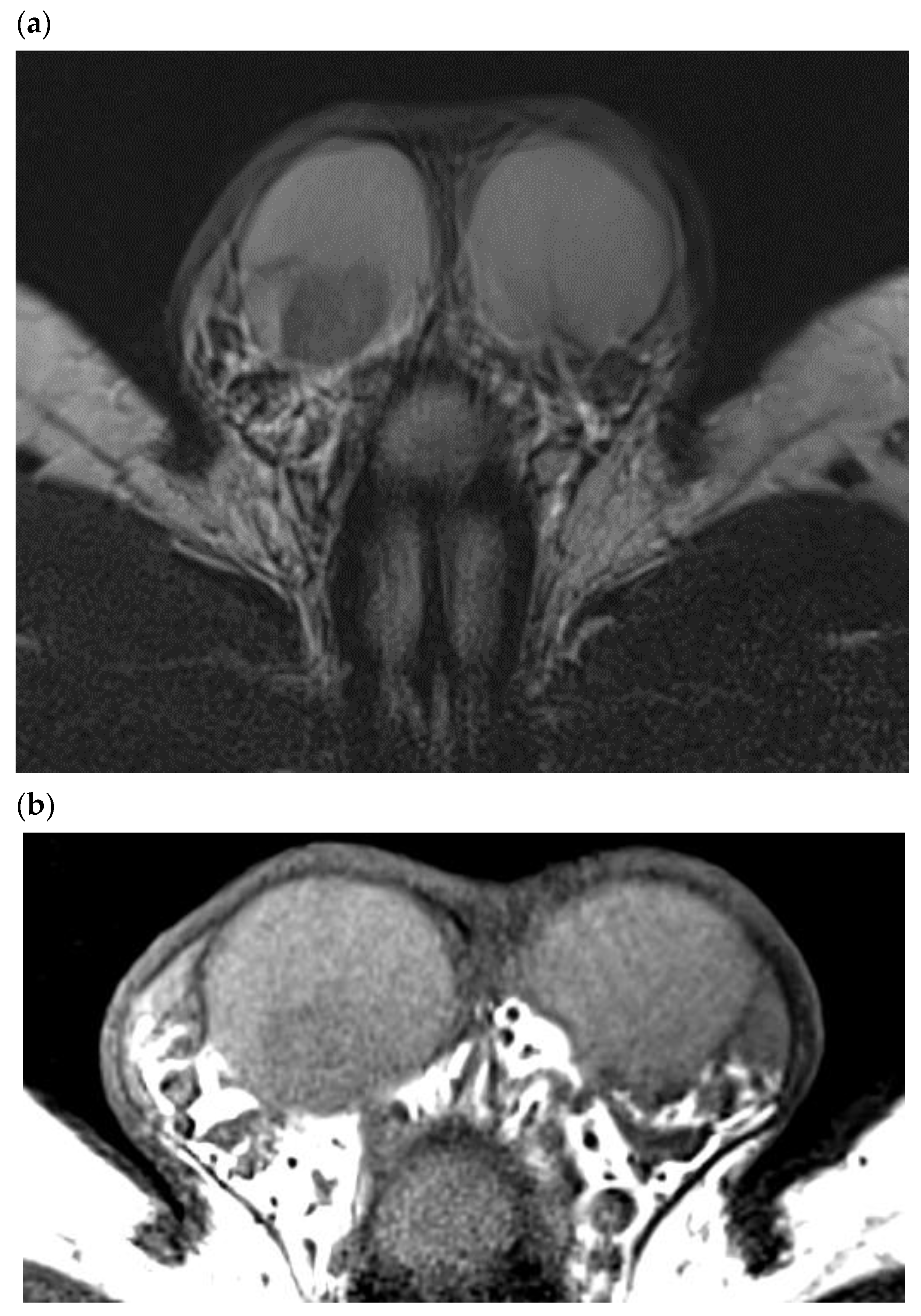 Cancers 14 03652 g006 Cancers 14 03652 g006