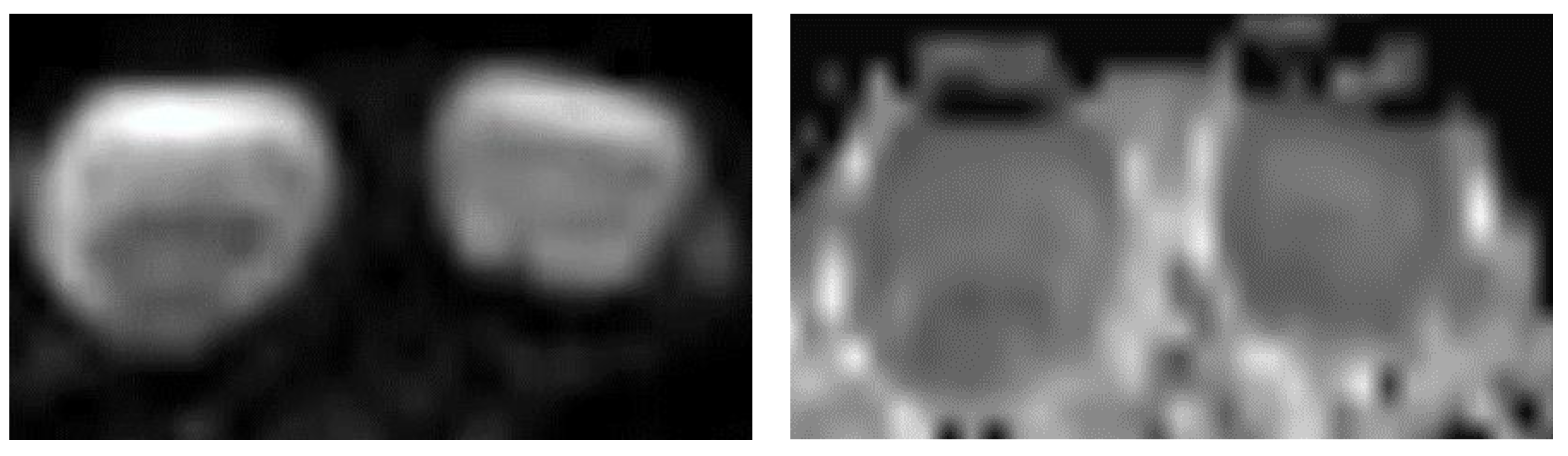 Cancers 14 03652 g007 Cancers 14 03652 g007