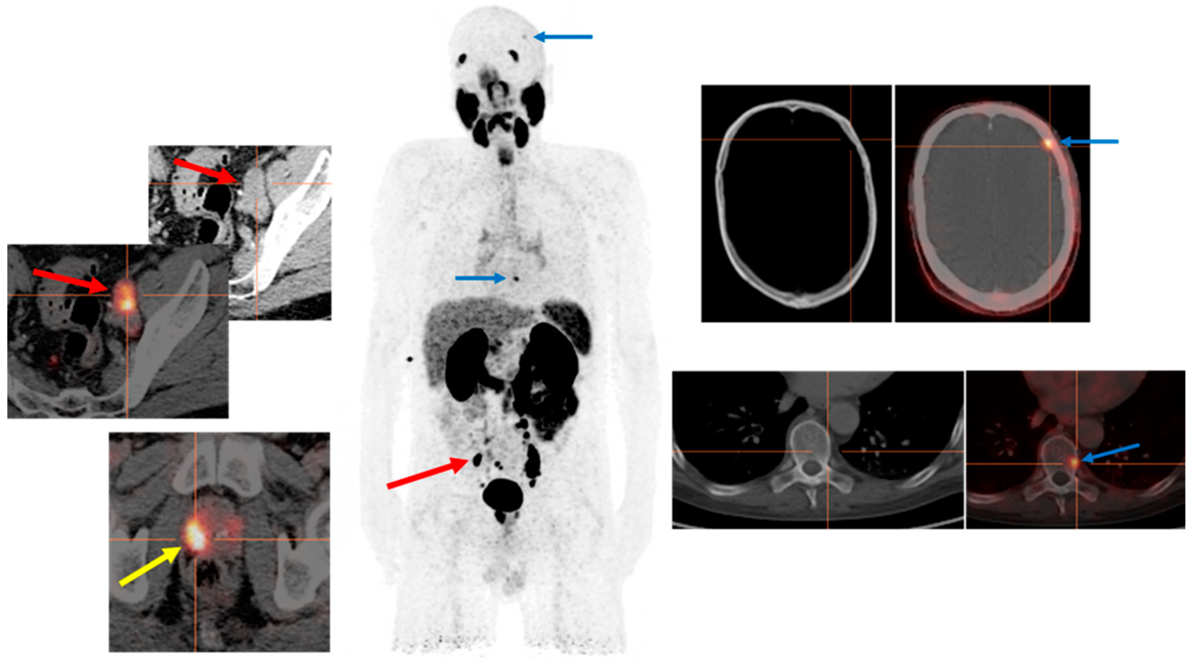 Cancers 14 03768 g001