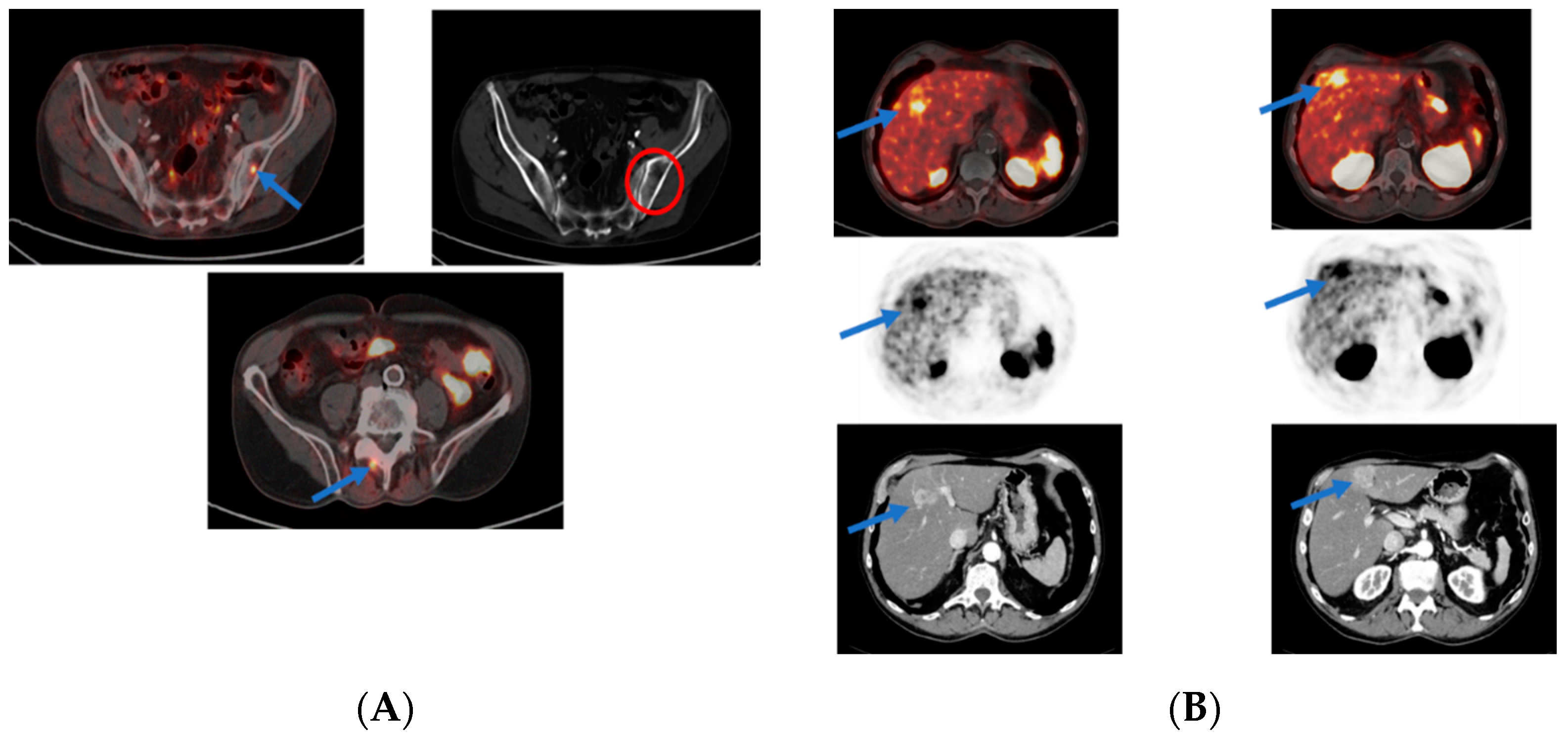 Cancers 14 03768 g003