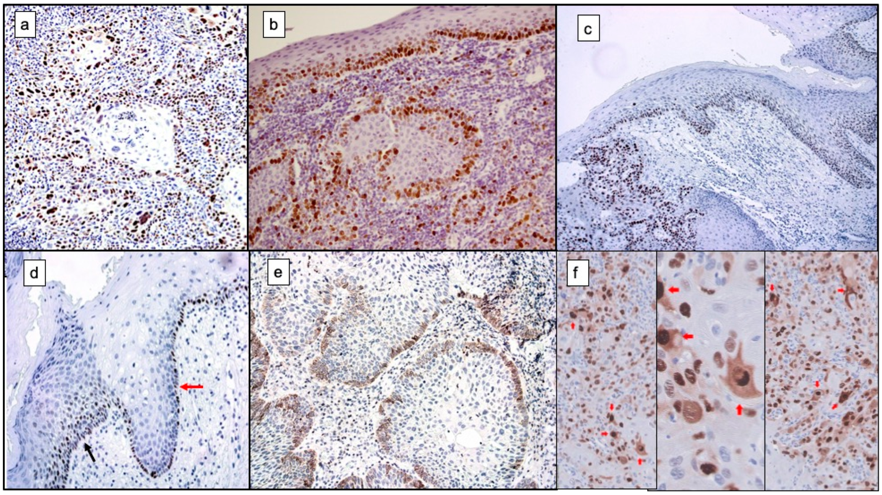 Cancers 14 03834 g003 Cancers 14 03834 g003