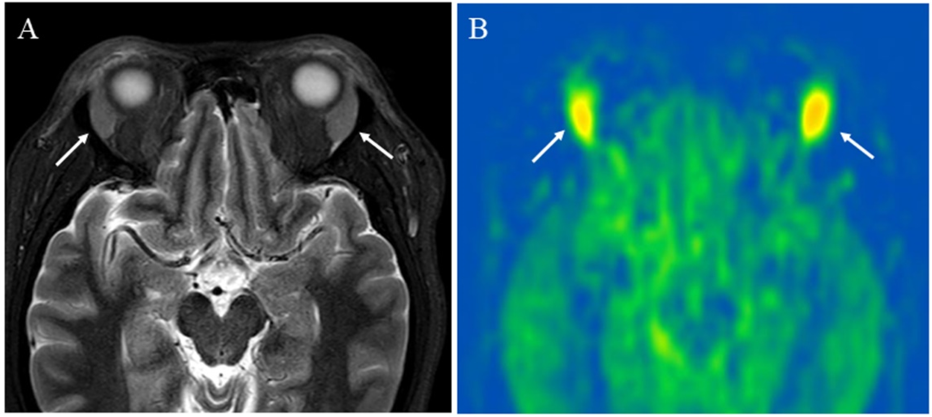 Cancers 14 03872 g005