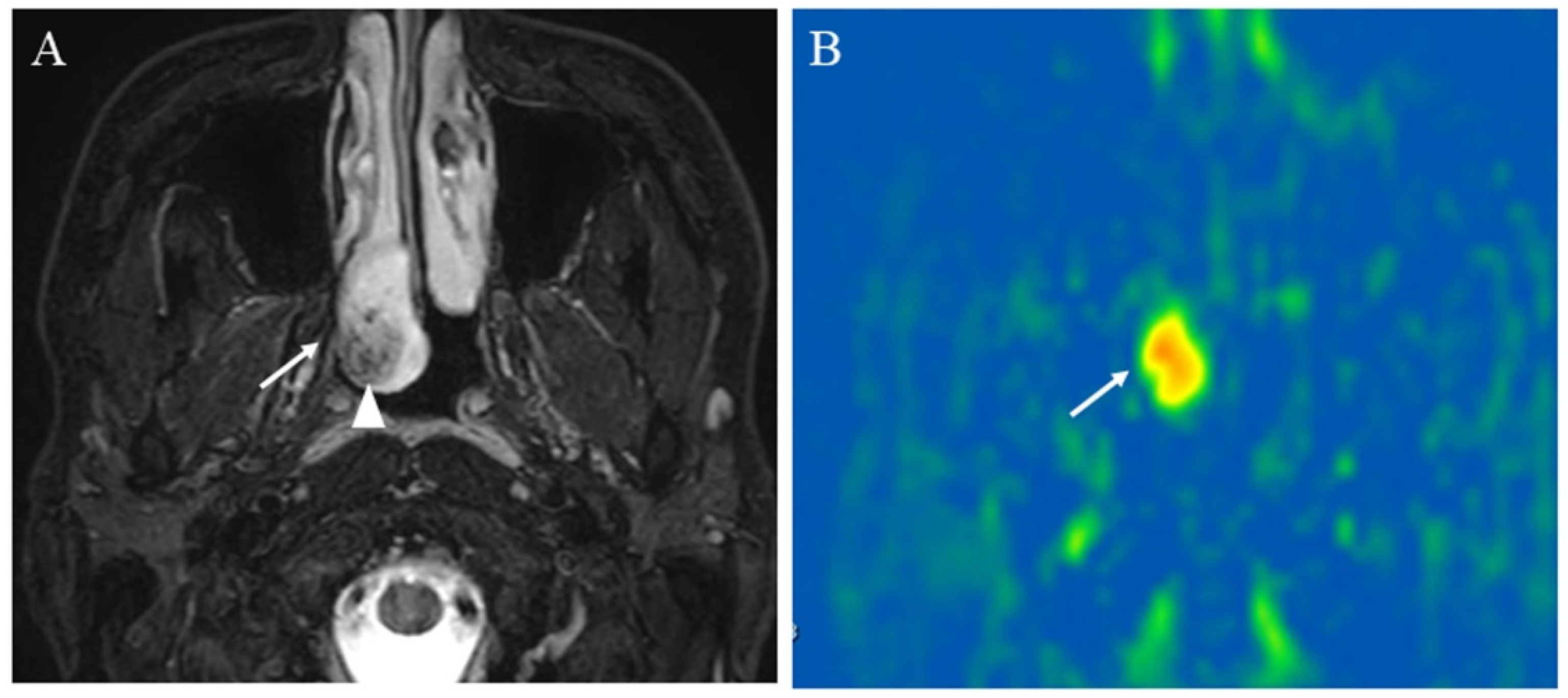 Cancers 14 03872 g008